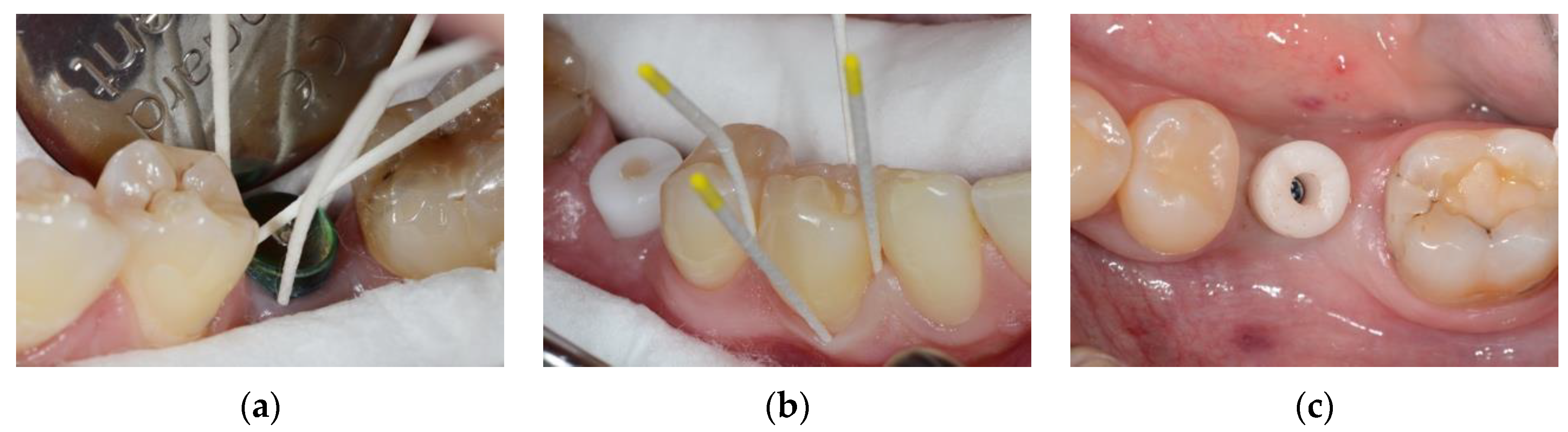 Diagnostics 15 00264 g001 Diagnostics 15 00264 g001