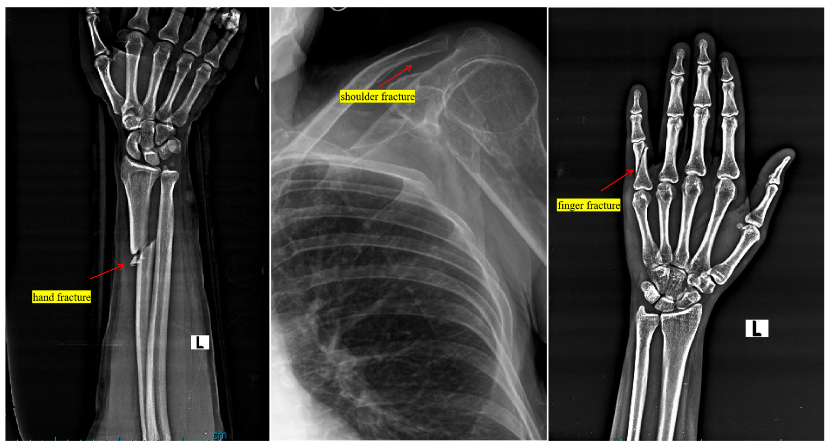 Diagnostics 15 00271 g003