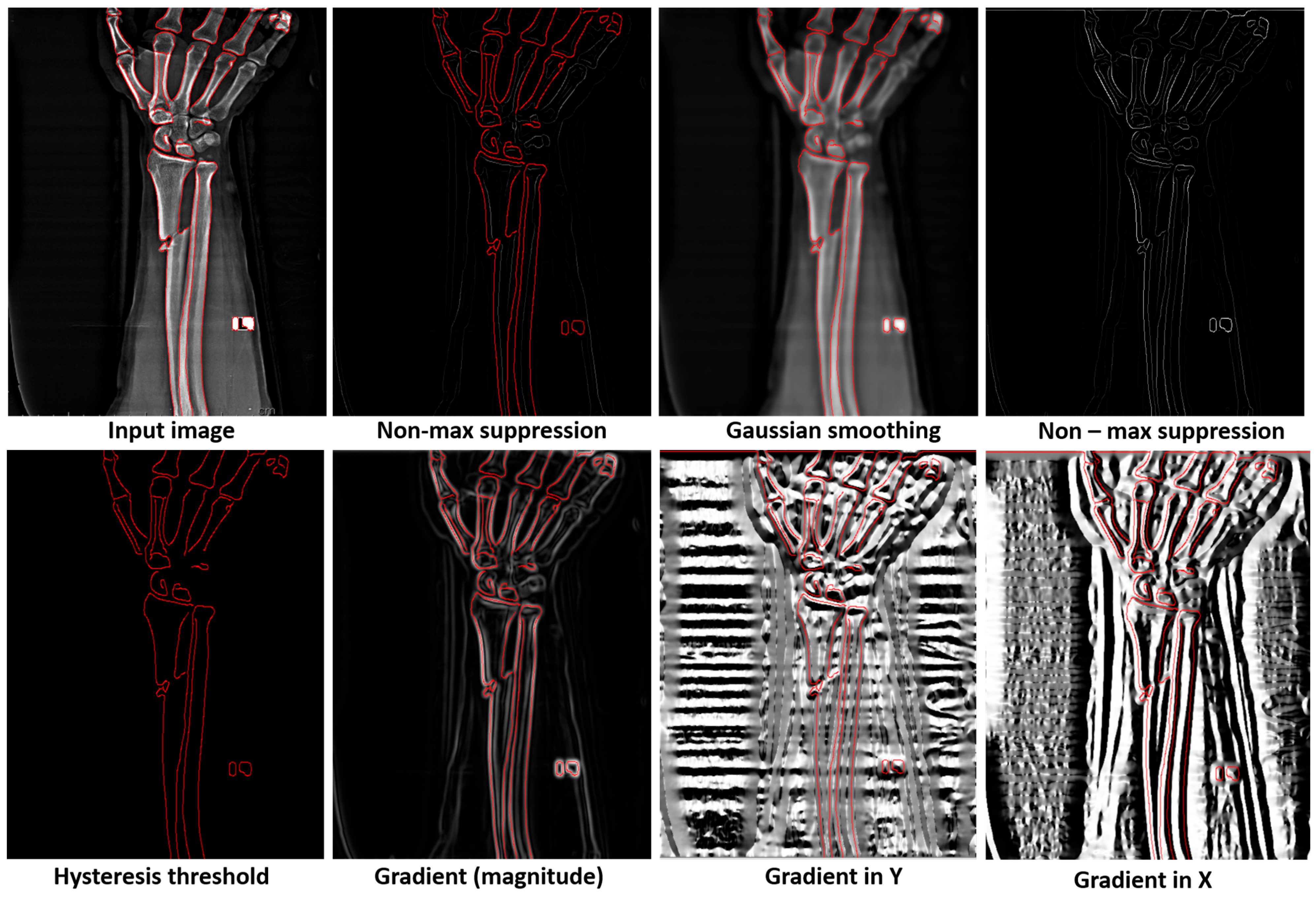 Diagnostics 15 00271 g006