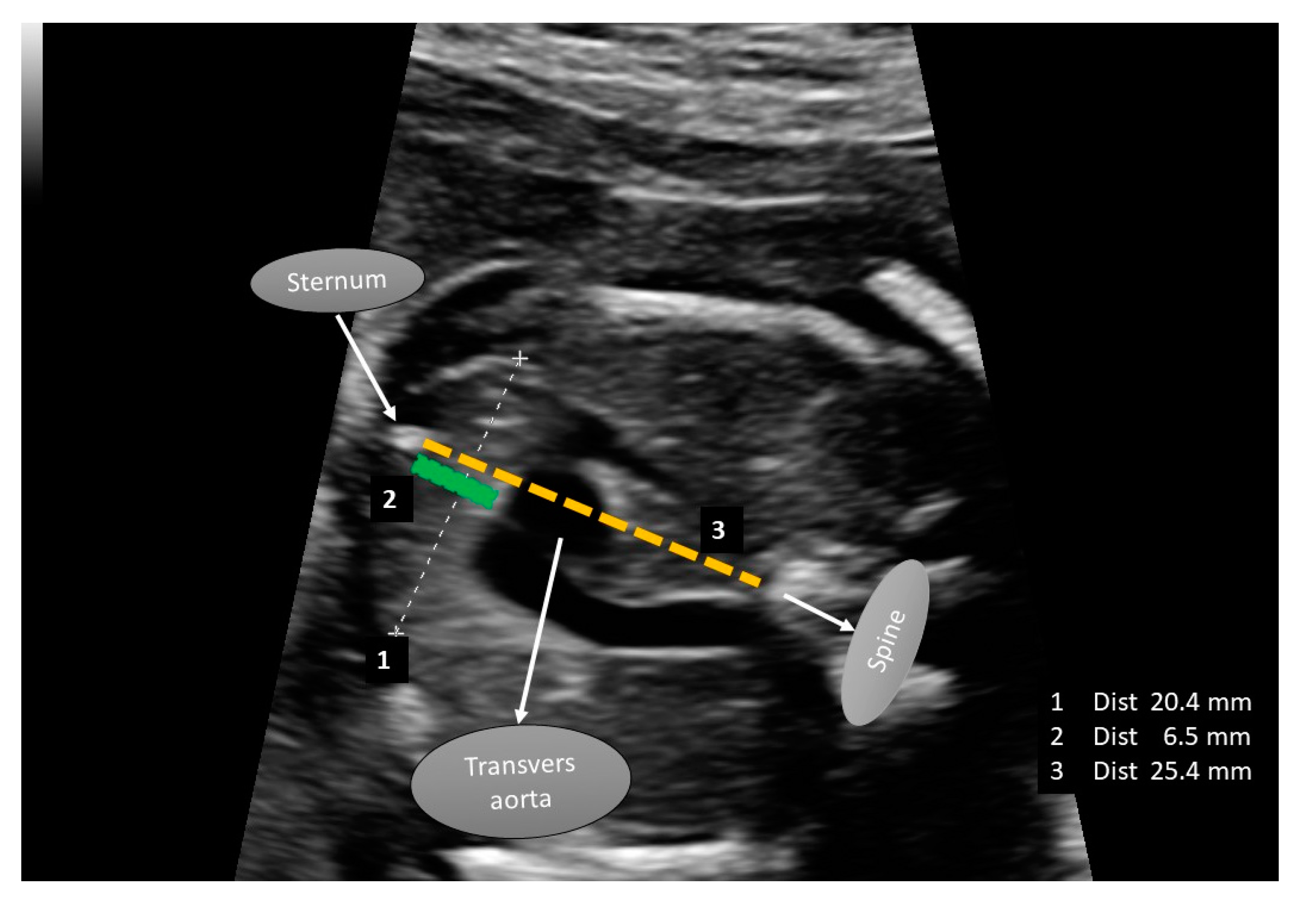 Diagnostics 15 00276 g002 Diagnostics 15 00276 g002