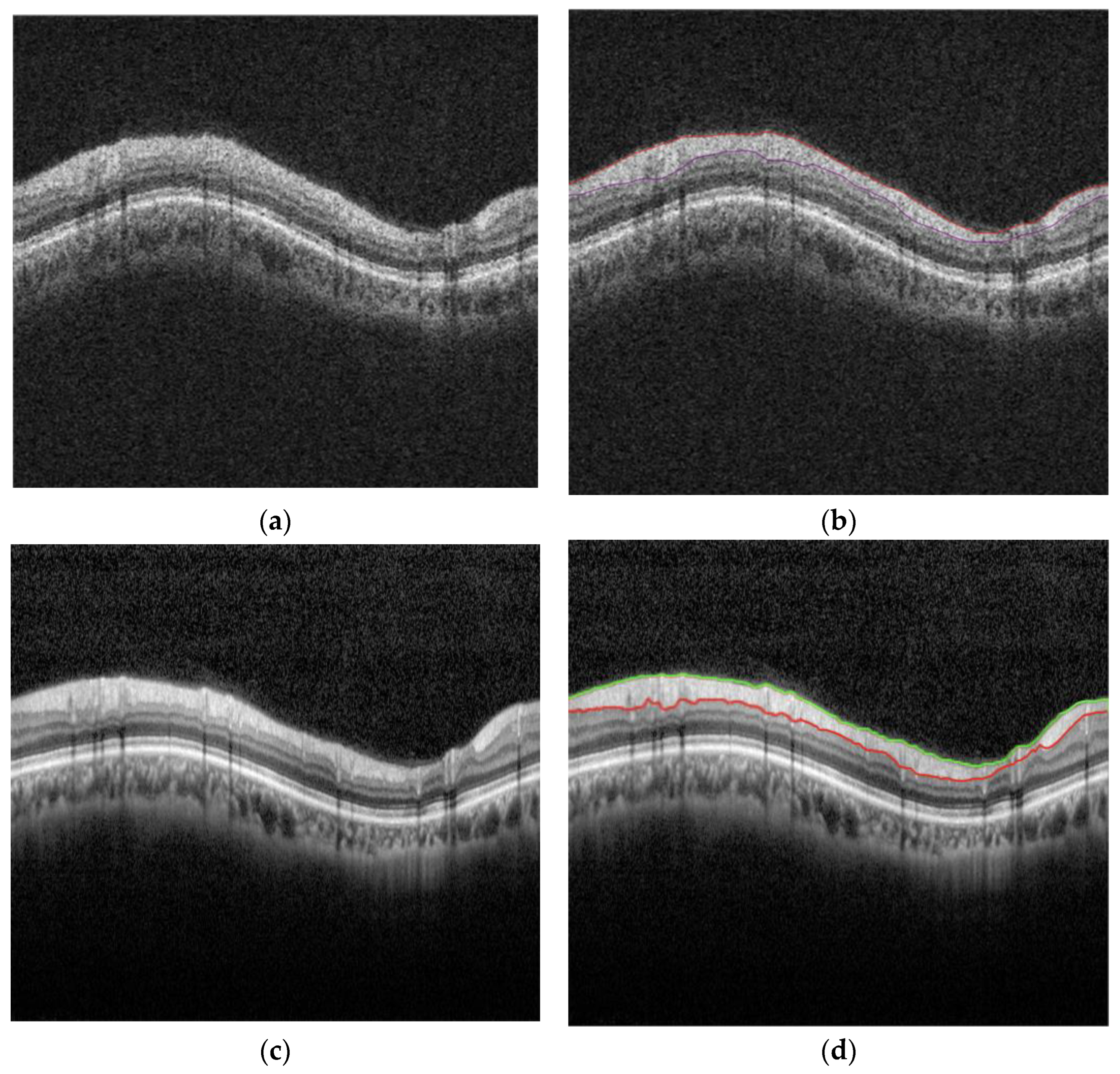 Diagnostics 15 00277 g001