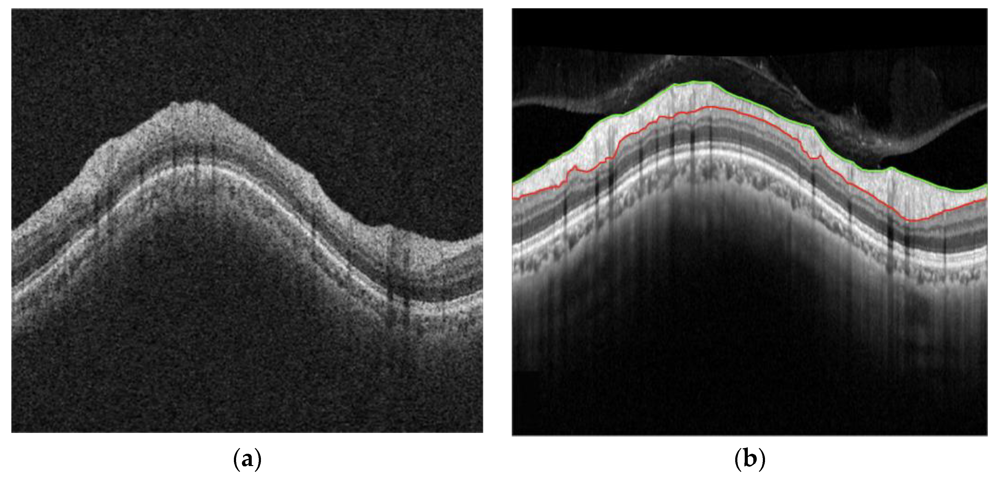 Diagnostics 15 00277 g002