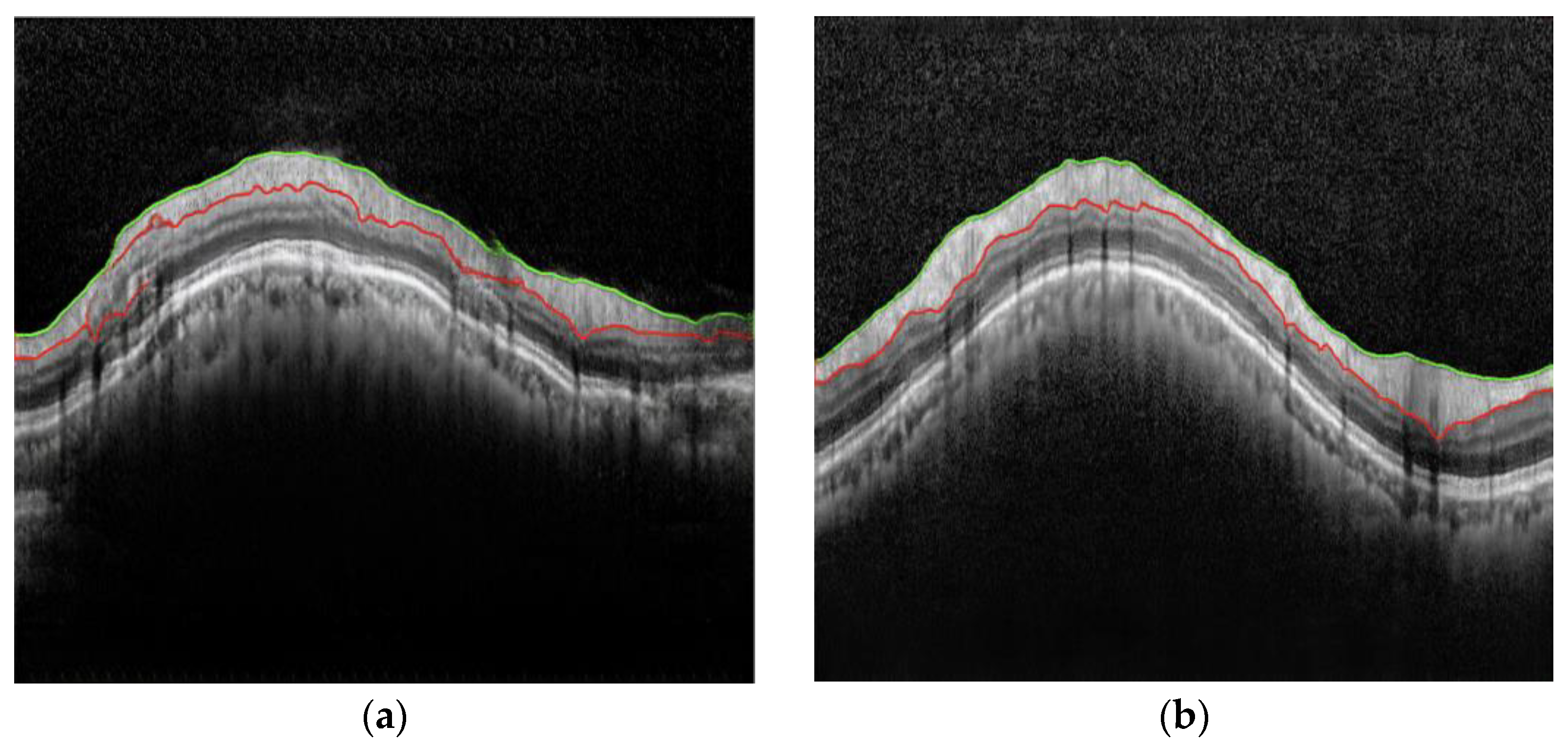 Diagnostics 15 00277 g003