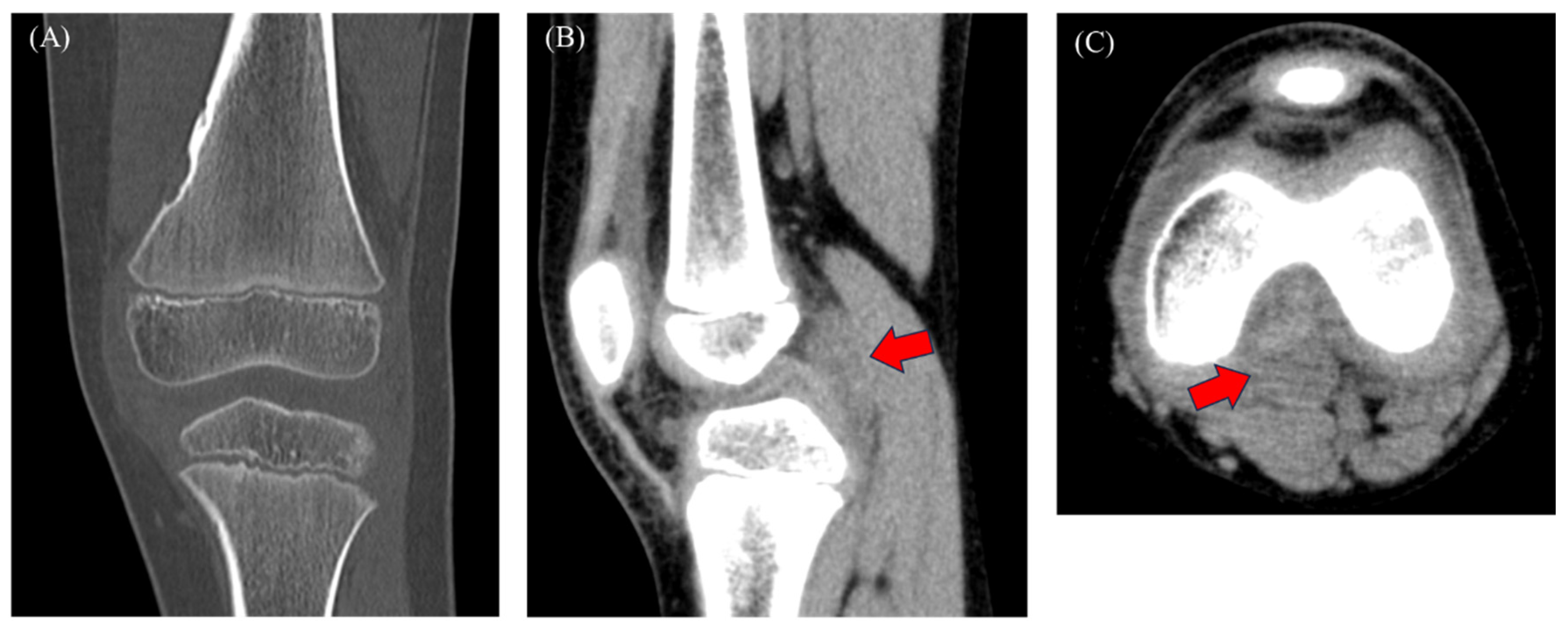 Diagnostics 15 00281 g002