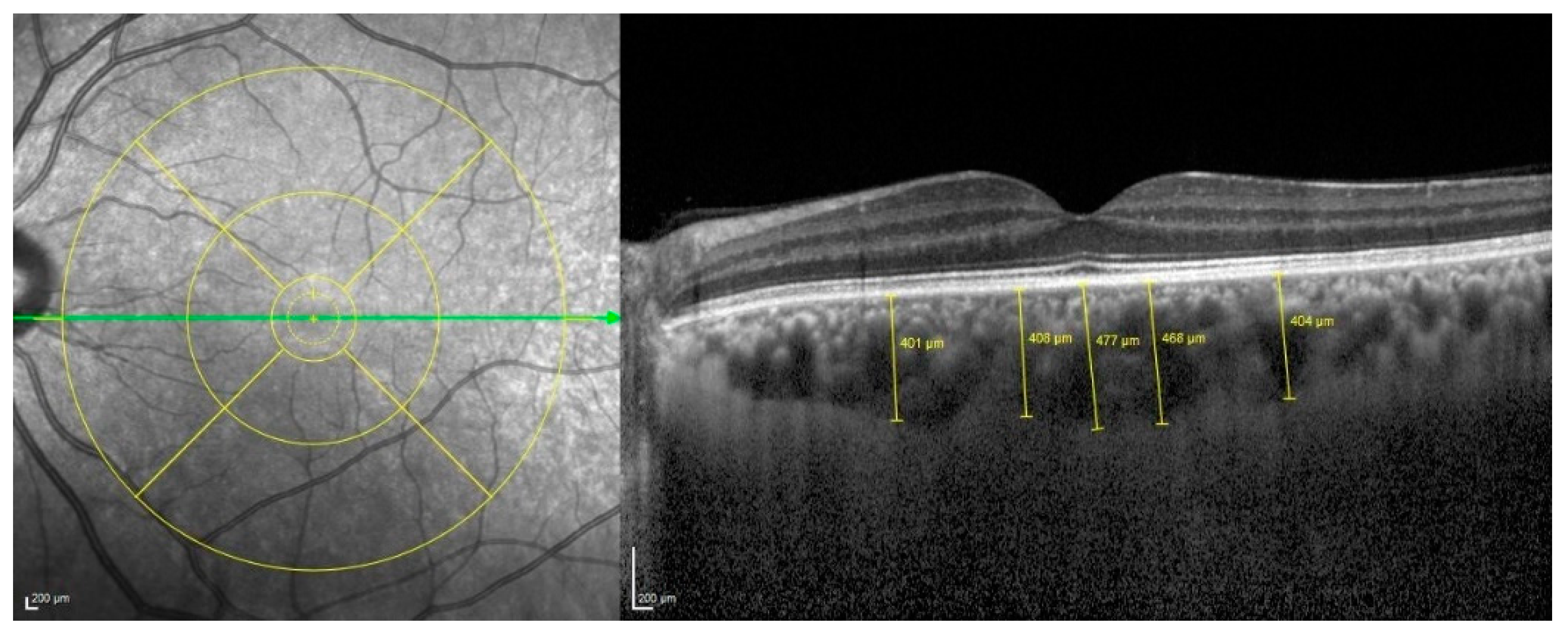 Diagnostics 15 00286 g002