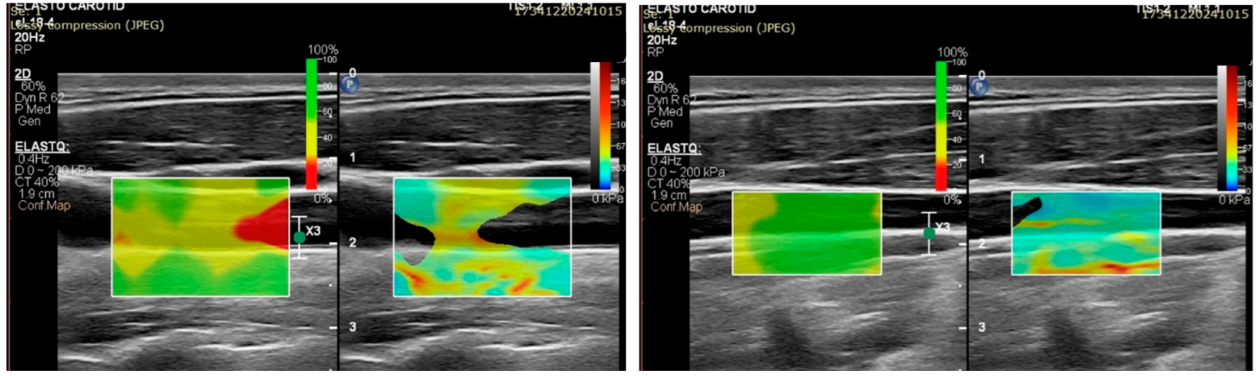 Diagnostics 15 00303 g002