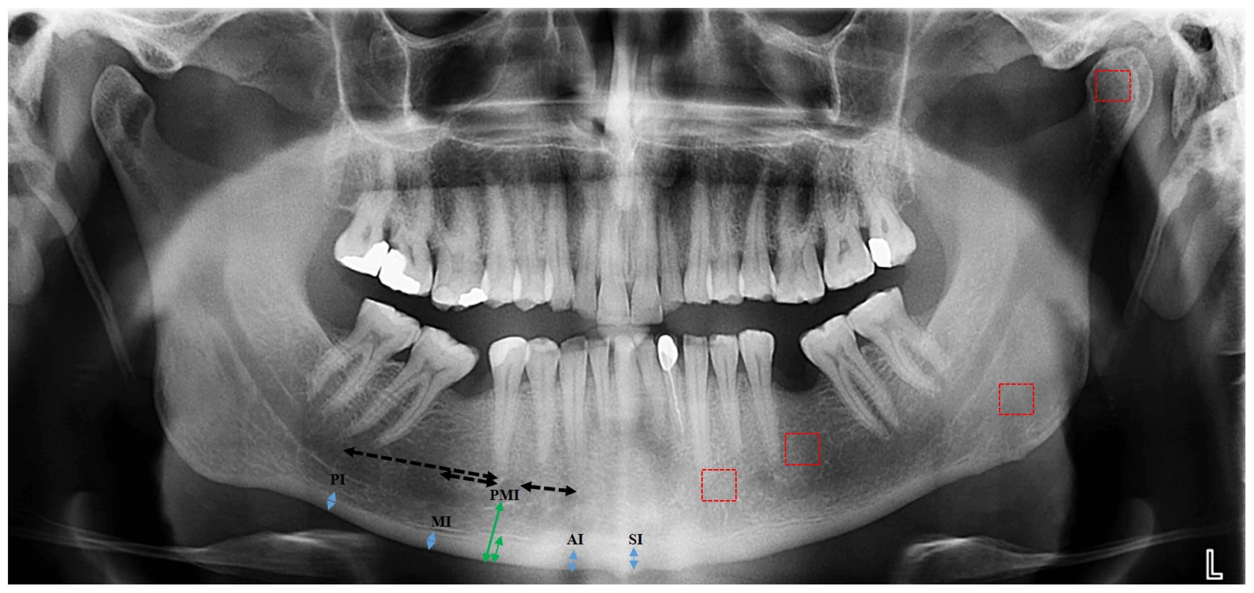 Diagnostics 15 00306 g001 Diagnostics 15 00306 g001