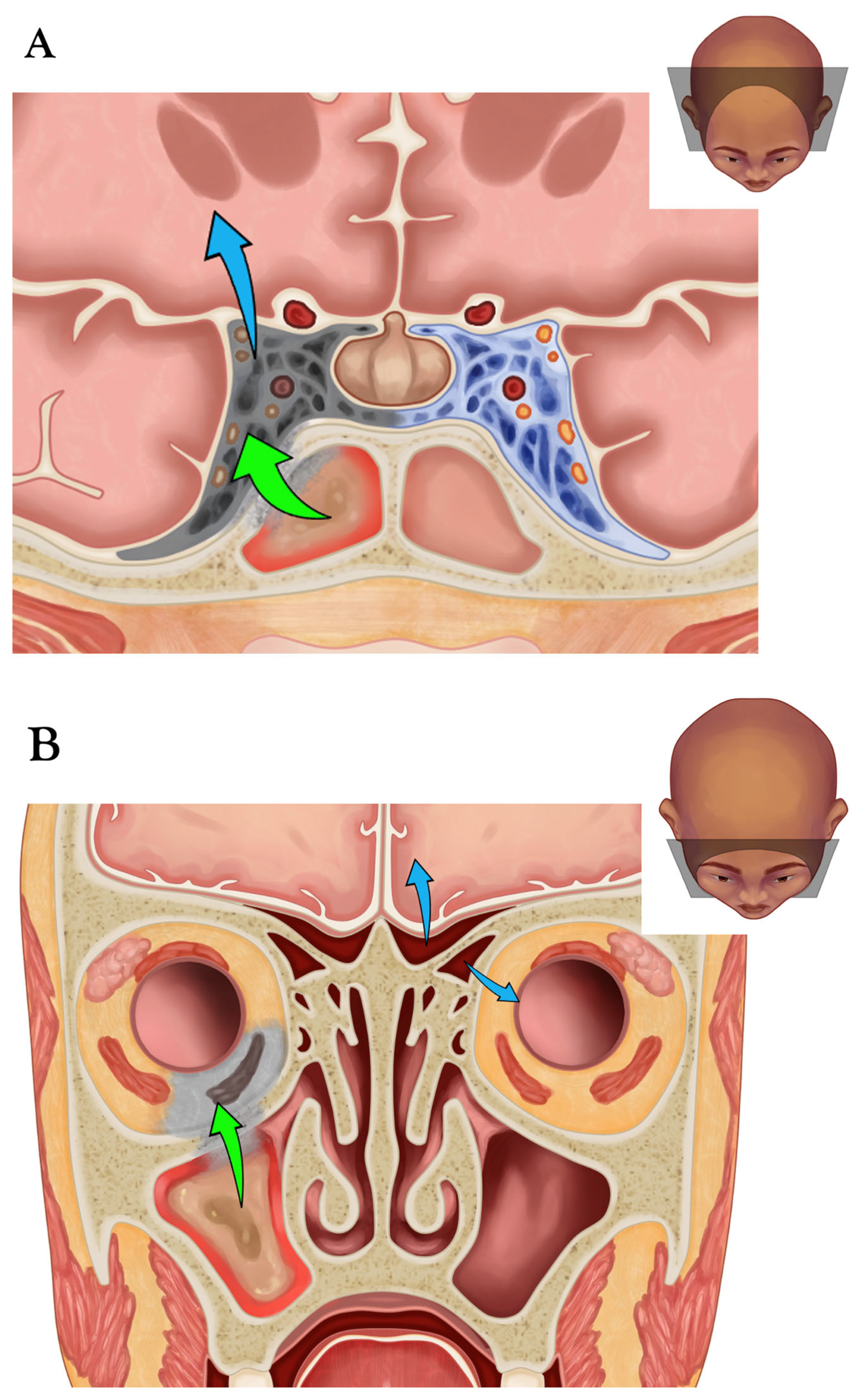 Diagnostics 15 00311 g001a
