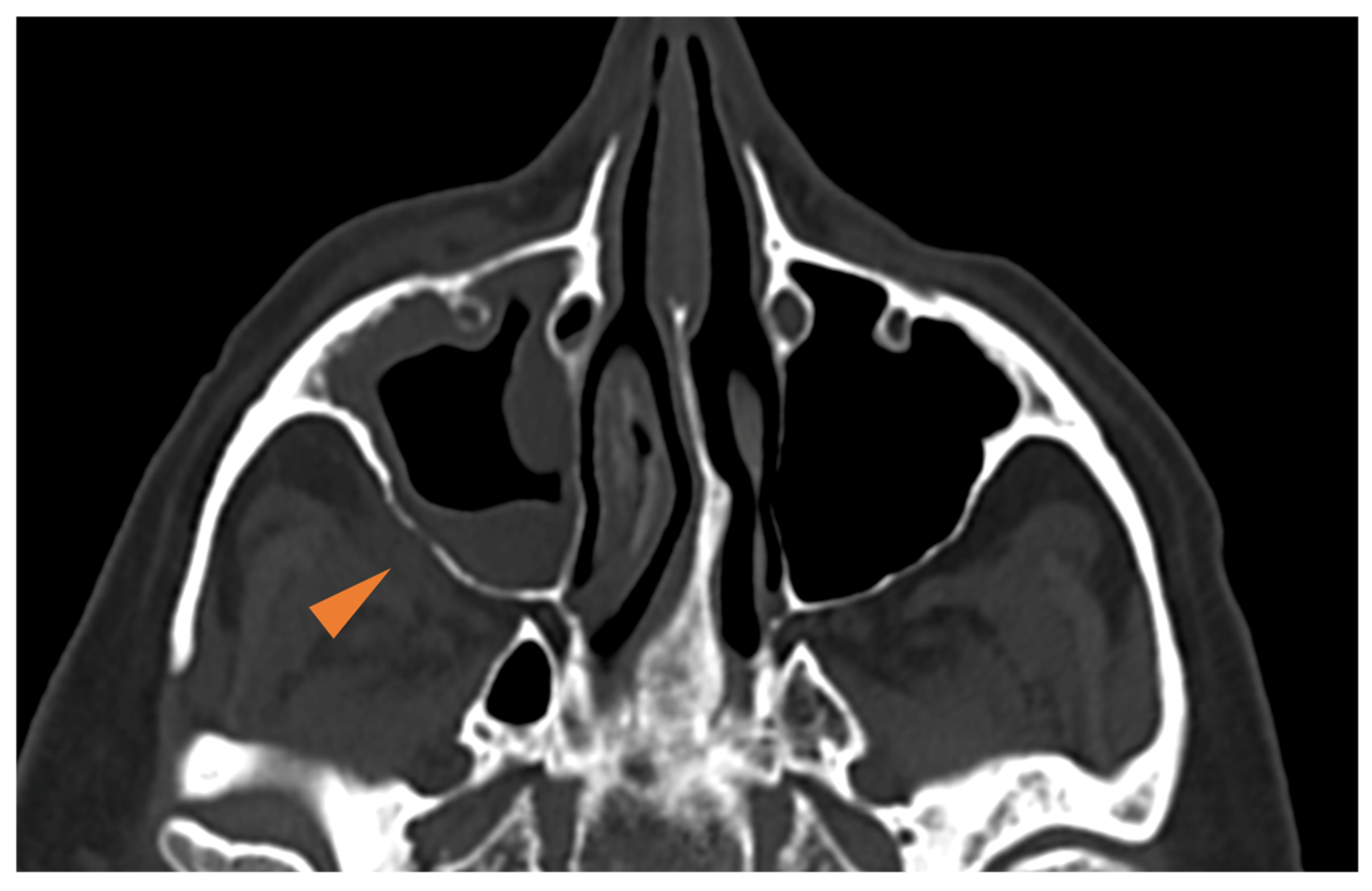 Diagnostics 15 00311 g004