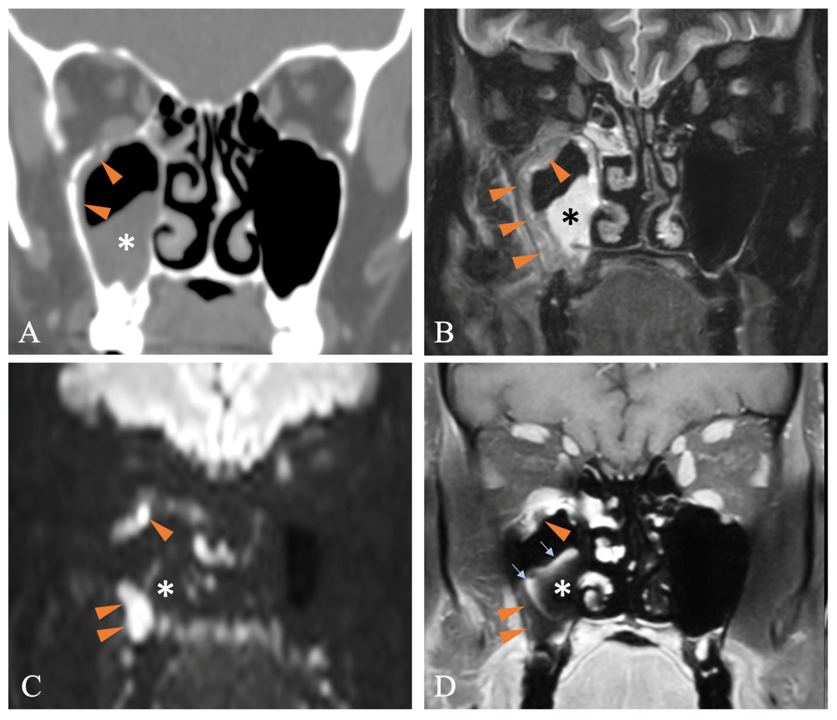 Diagnostics 15 00311 g005