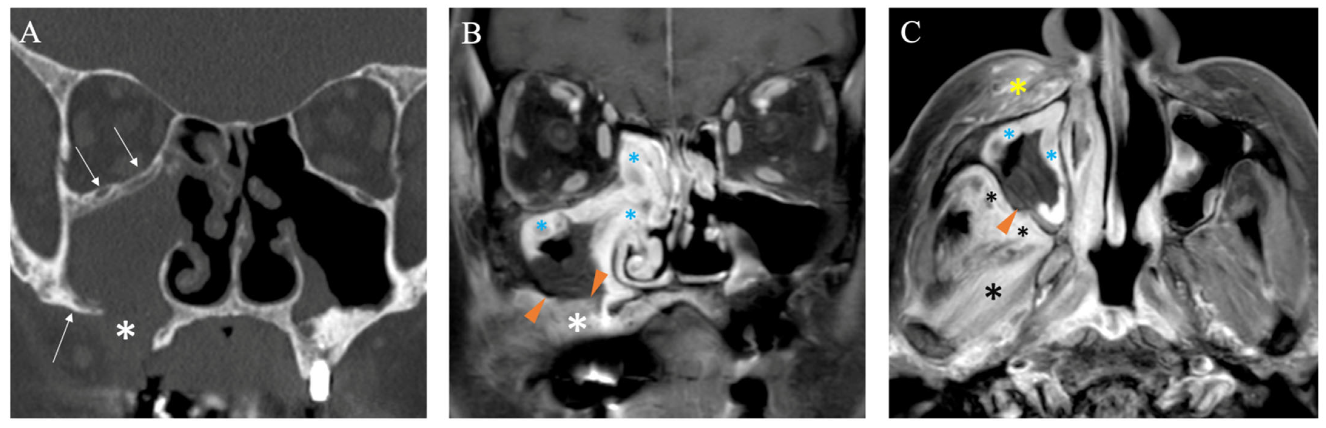 Diagnostics 15 00311 g006