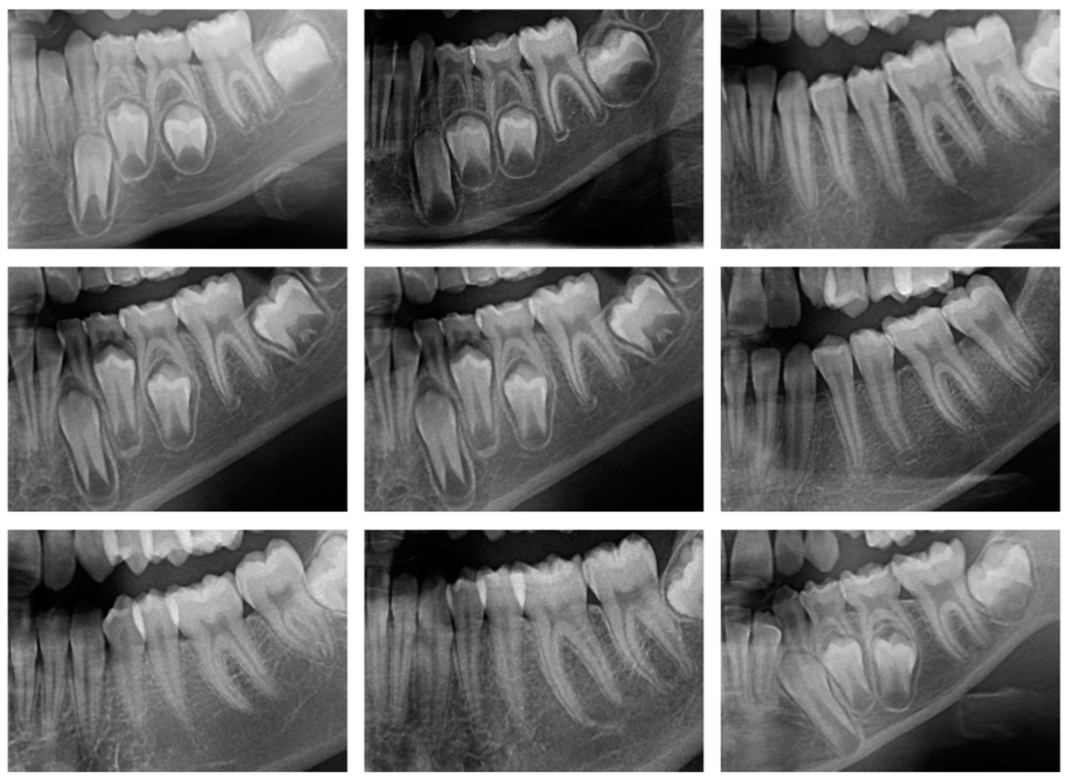Diagnostics 15 00314 g004