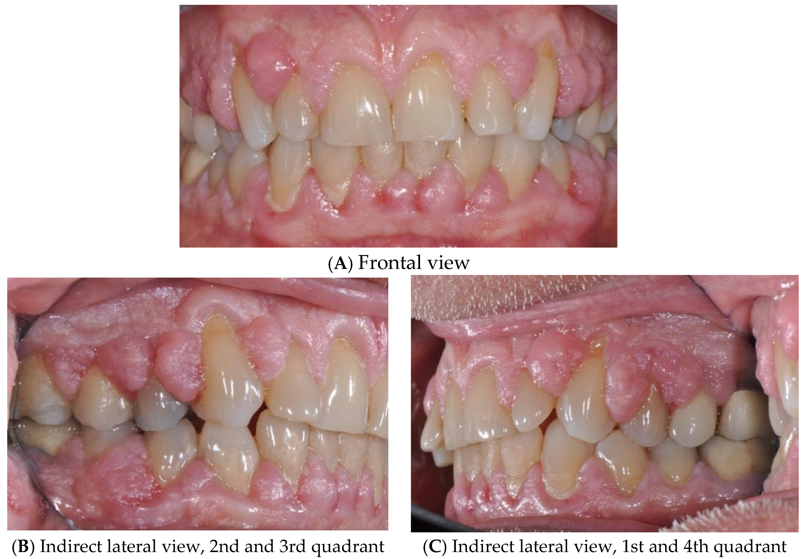 Diagnostics 15 00320 g001 Diagnostics 15 00320 g001