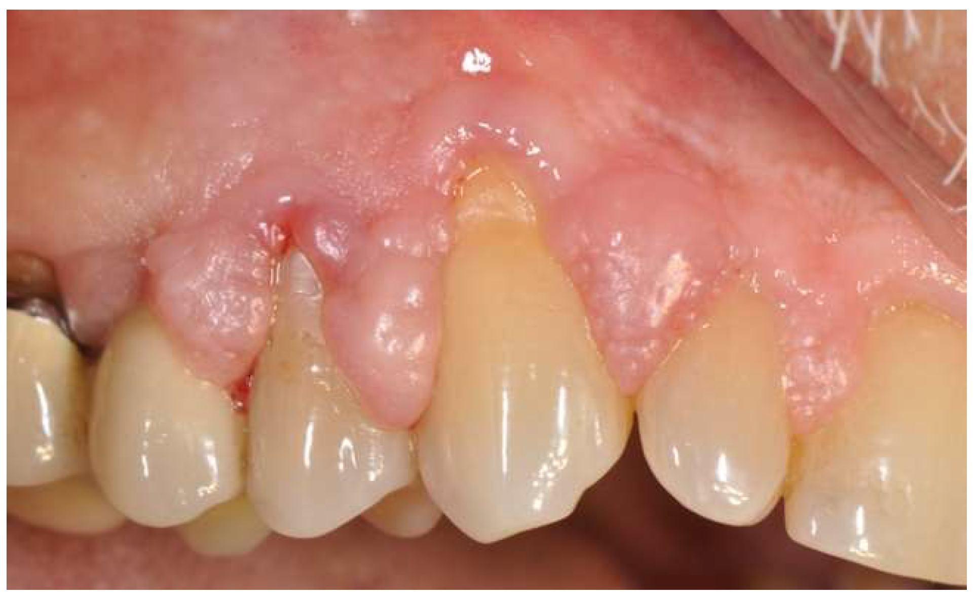 Diagnostics 15 00320 g002 Diagnostics 15 00320 g002