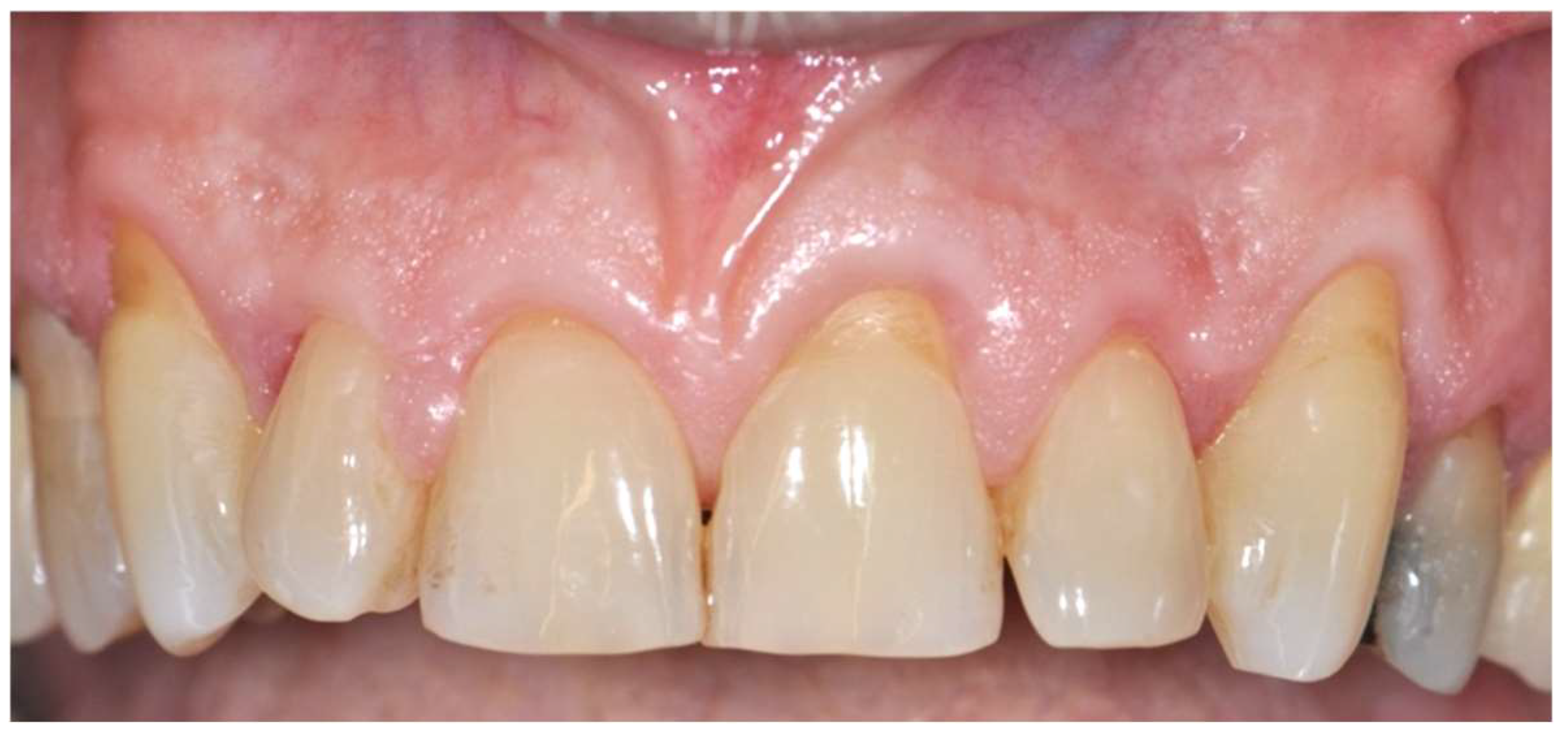 Diagnostics 15 00320 g003 Diagnostics 15 00320 g003