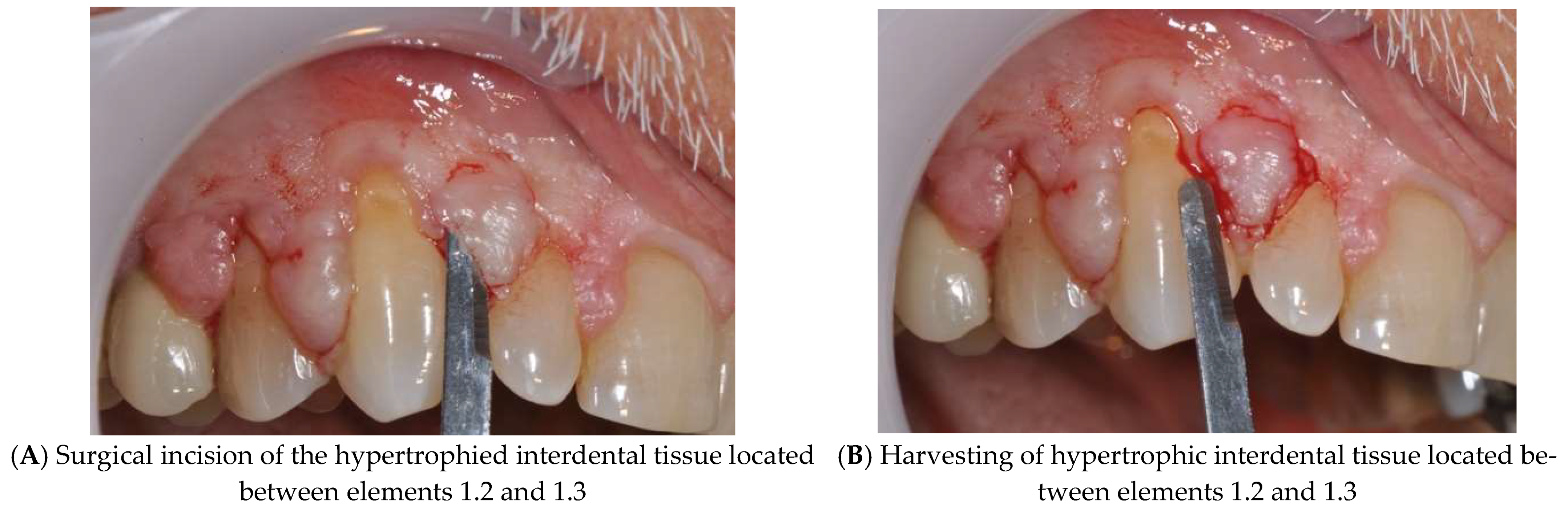 Diagnostics 15 00320 g004 Diagnostics 15 00320 g004