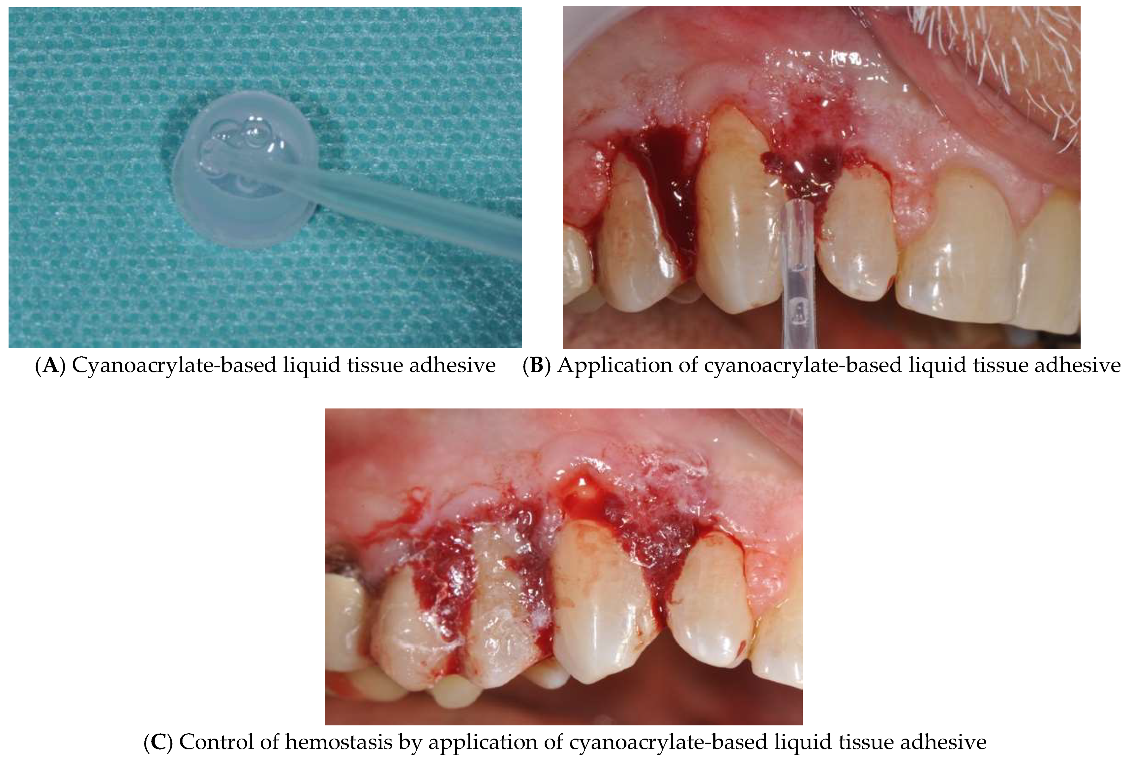 Diagnostics 15 00320 g005 Diagnostics 15 00320 g005