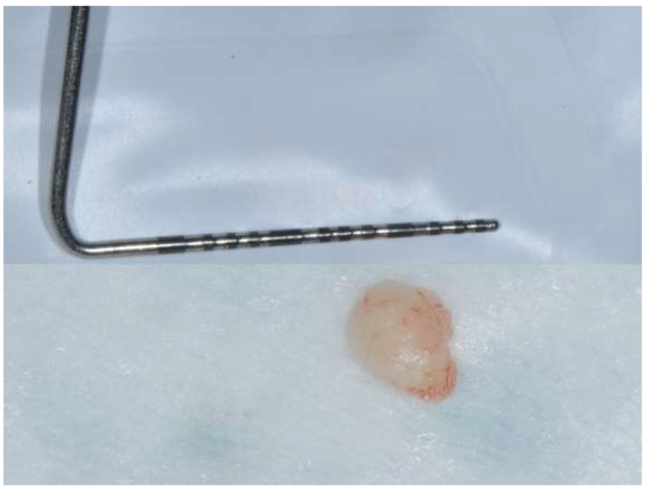 Diagnostics 15 00320 g006 Diagnostics 15 00320 g006