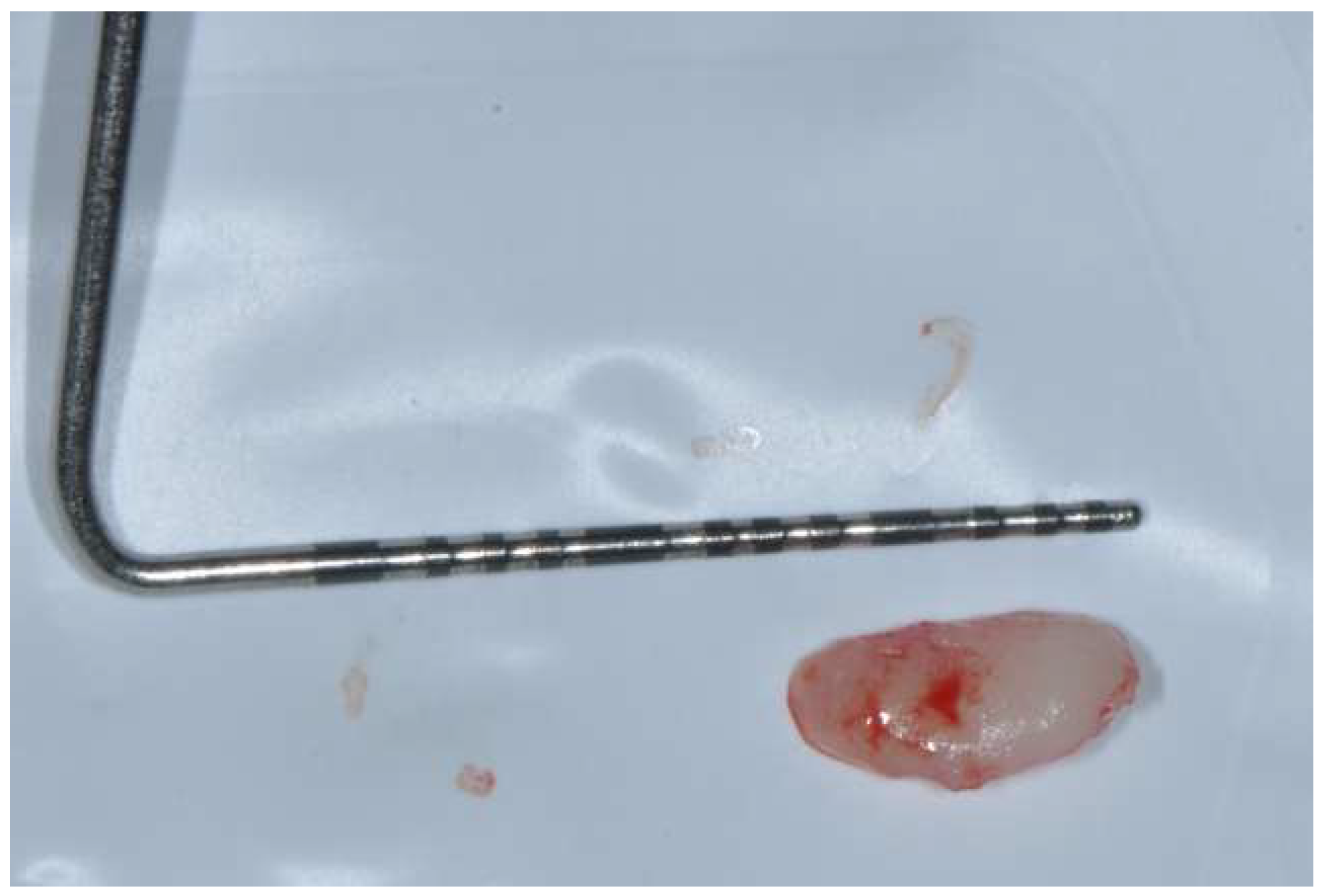 Diagnostics 15 00320 g007 Diagnostics 15 00320 g007