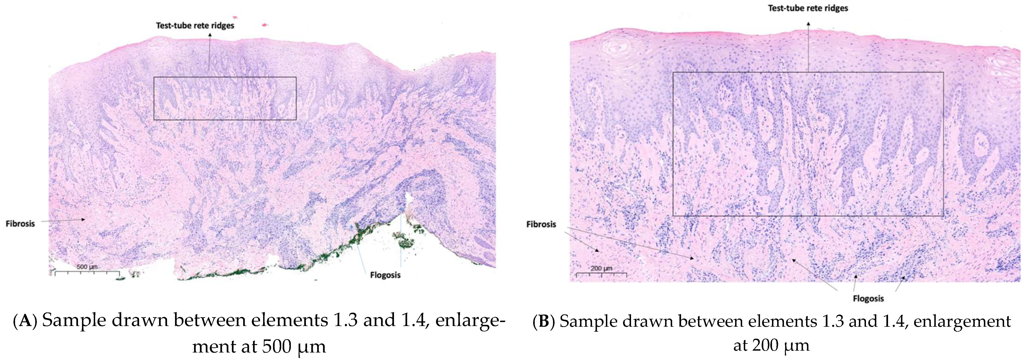 Diagnostics 15 00320 g010 Diagnostics 15 00320 g010