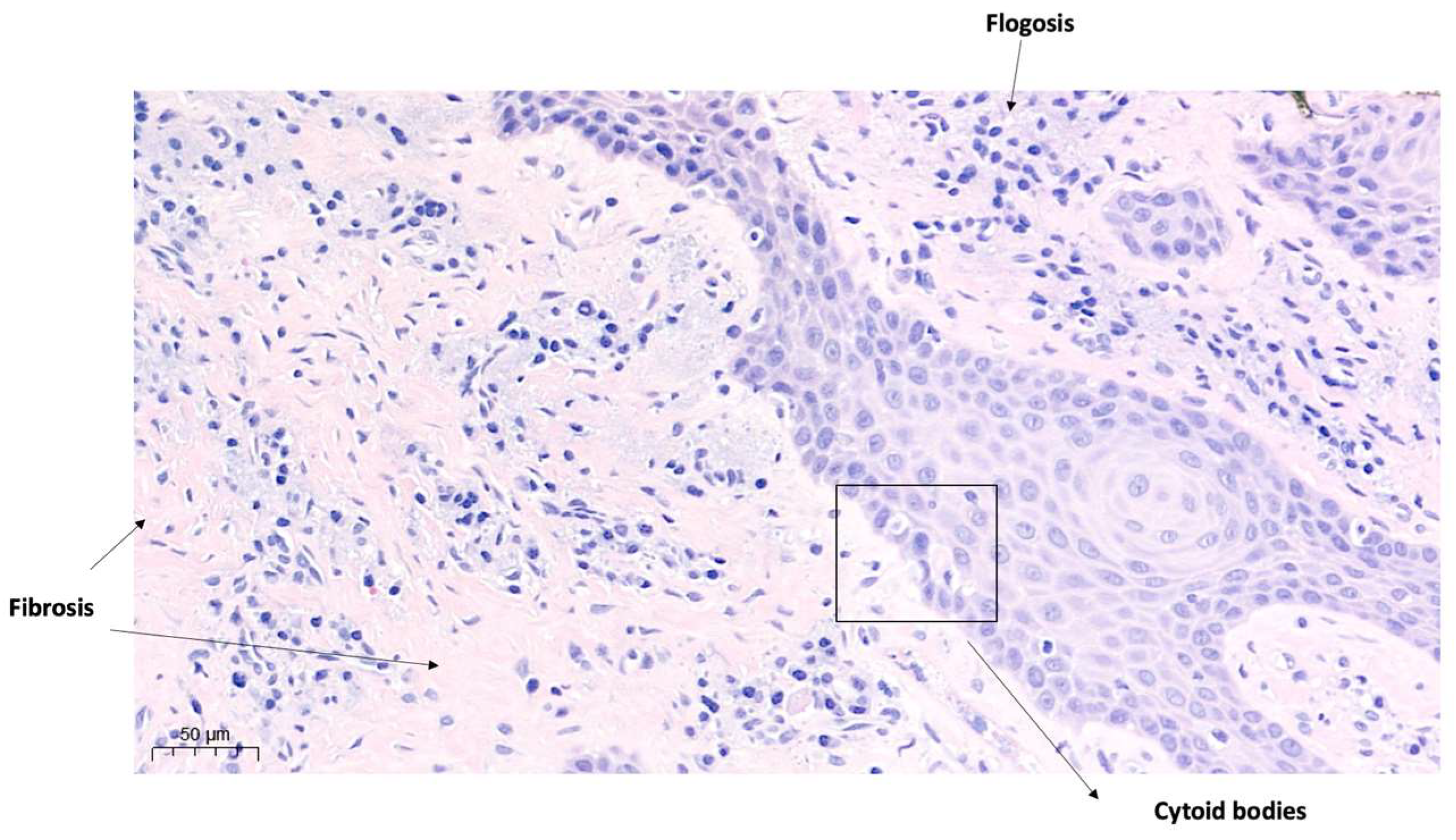 Diagnostics 15 00320 g011 Diagnostics 15 00320 g011
