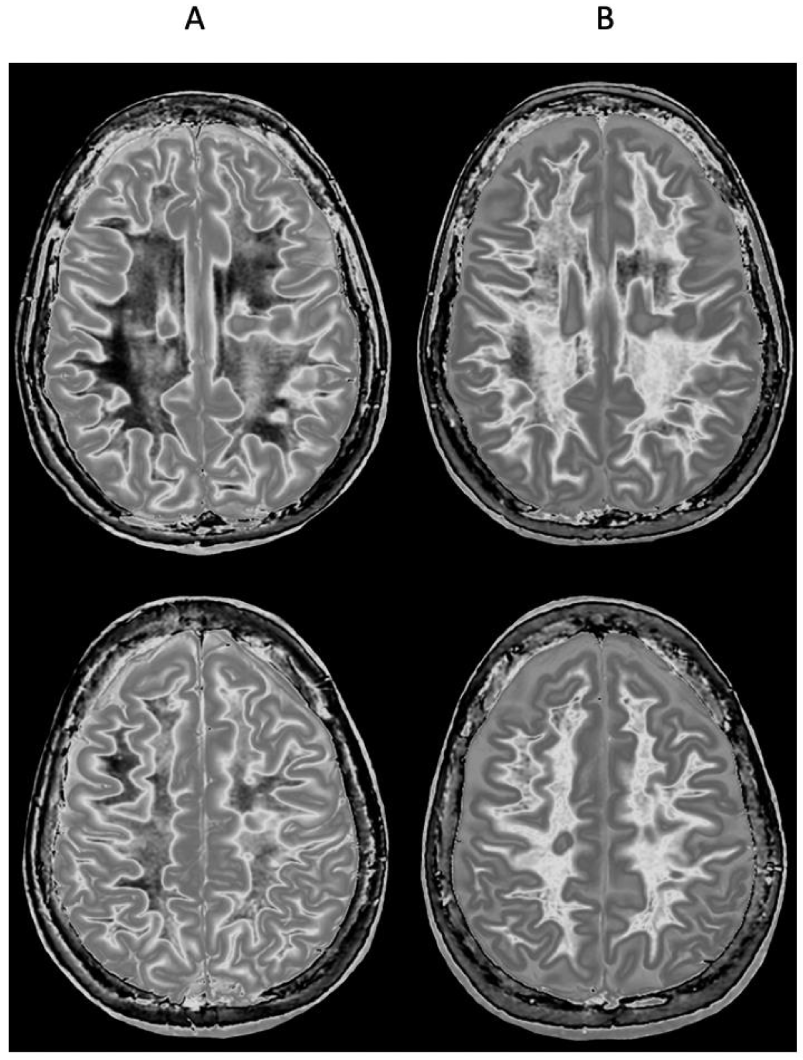 Diagnostics 15 00329 g010
