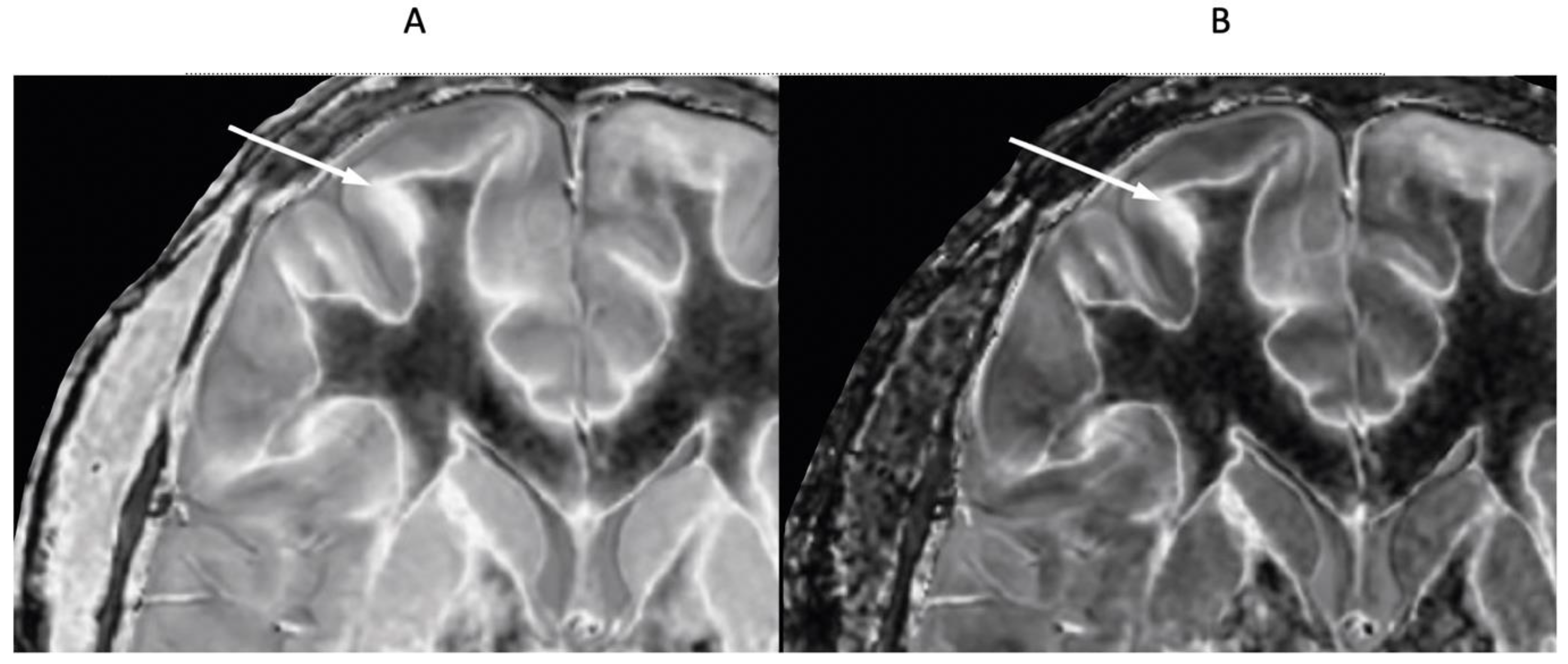 Diagnostics 15 00329 g014
