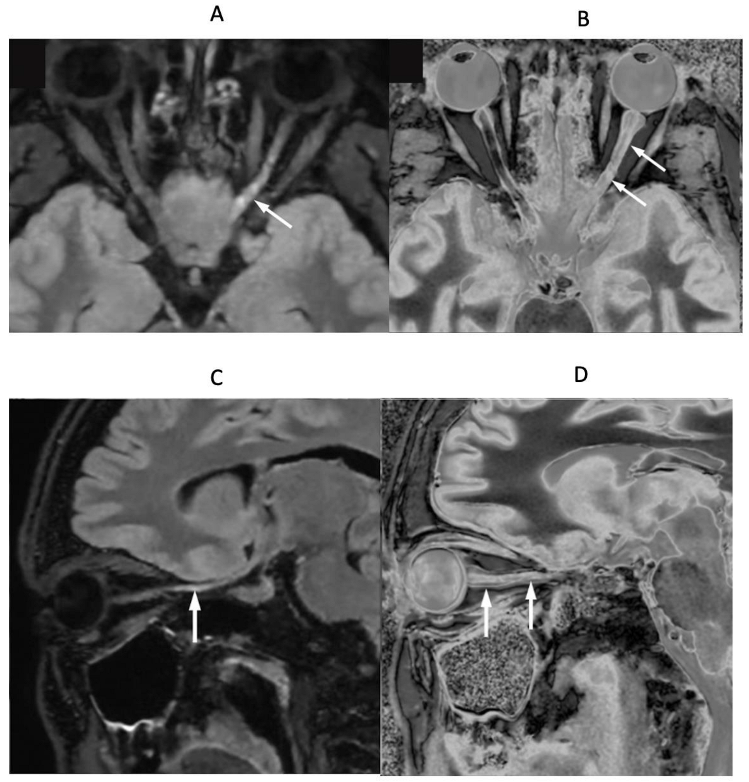Diagnostics 15 00329 g017