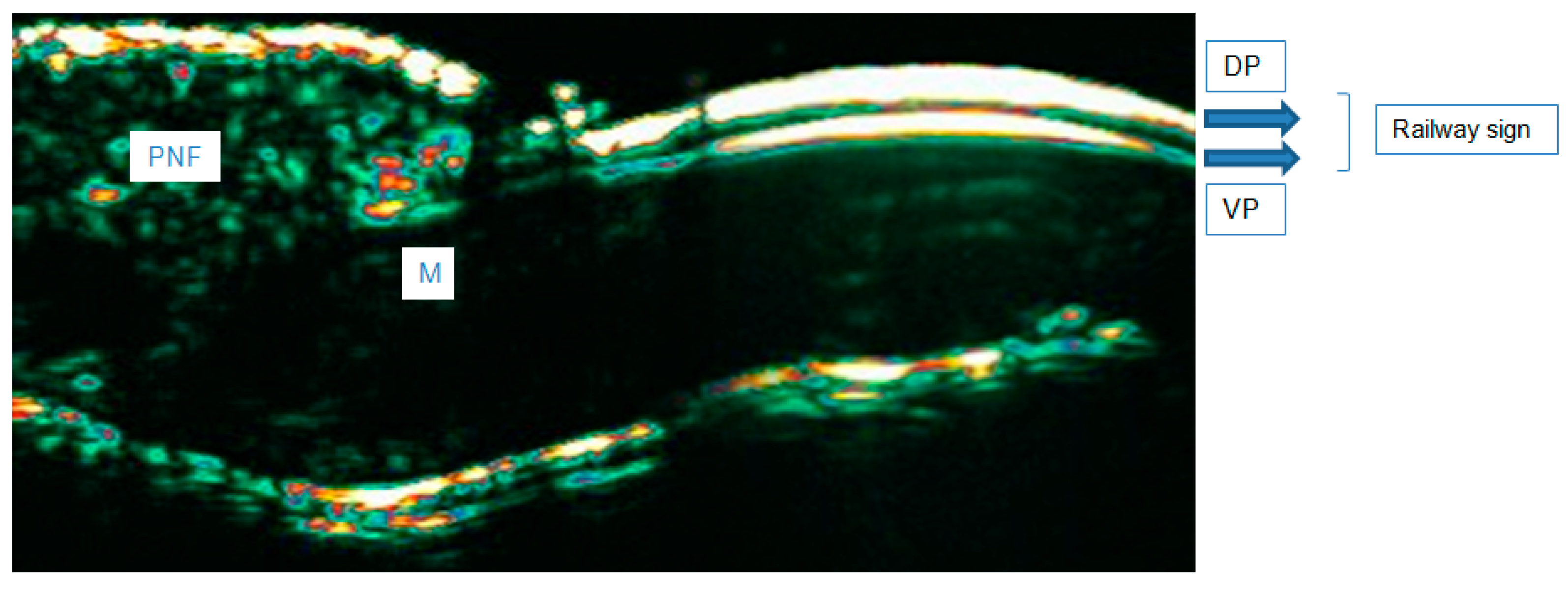 Diagnostics 15 00332 g004