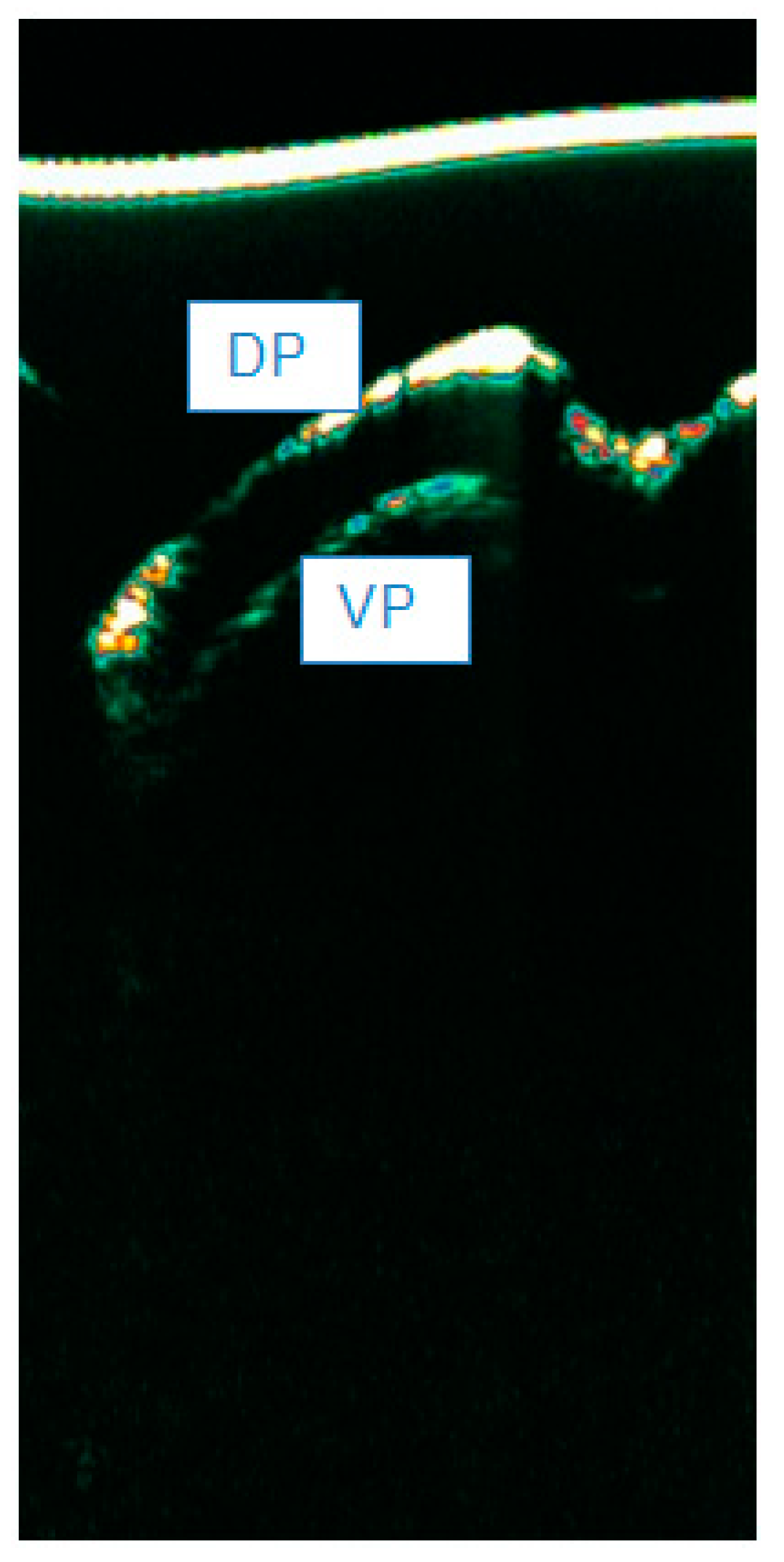 Diagnostics 15 00332 g005