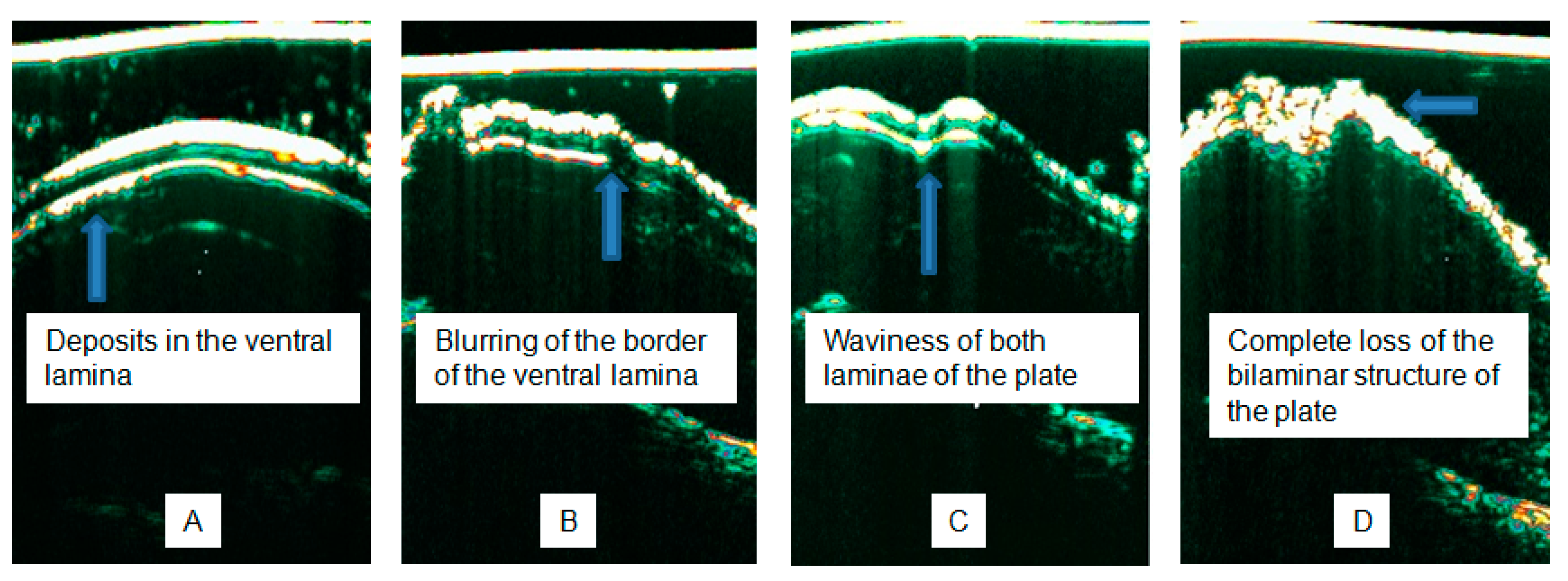 Diagnostics 15 00332 g006