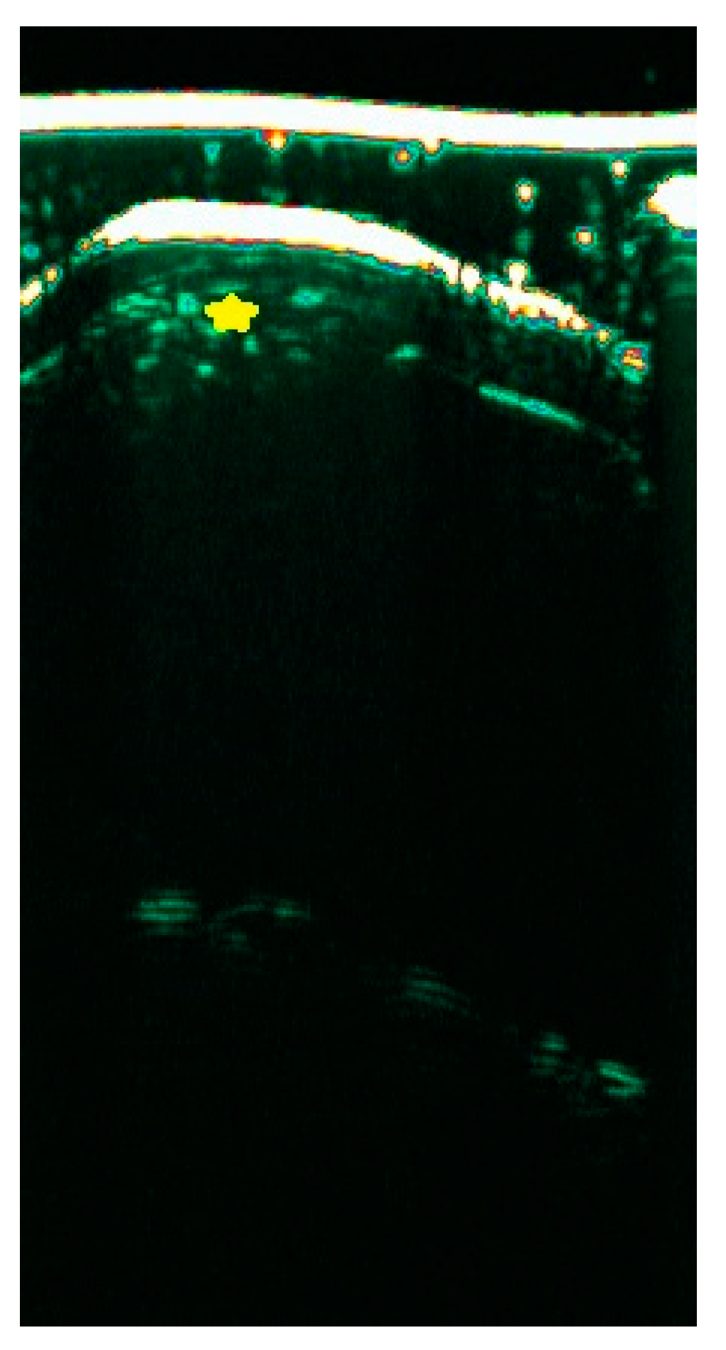 Diagnostics 15 00332 g007