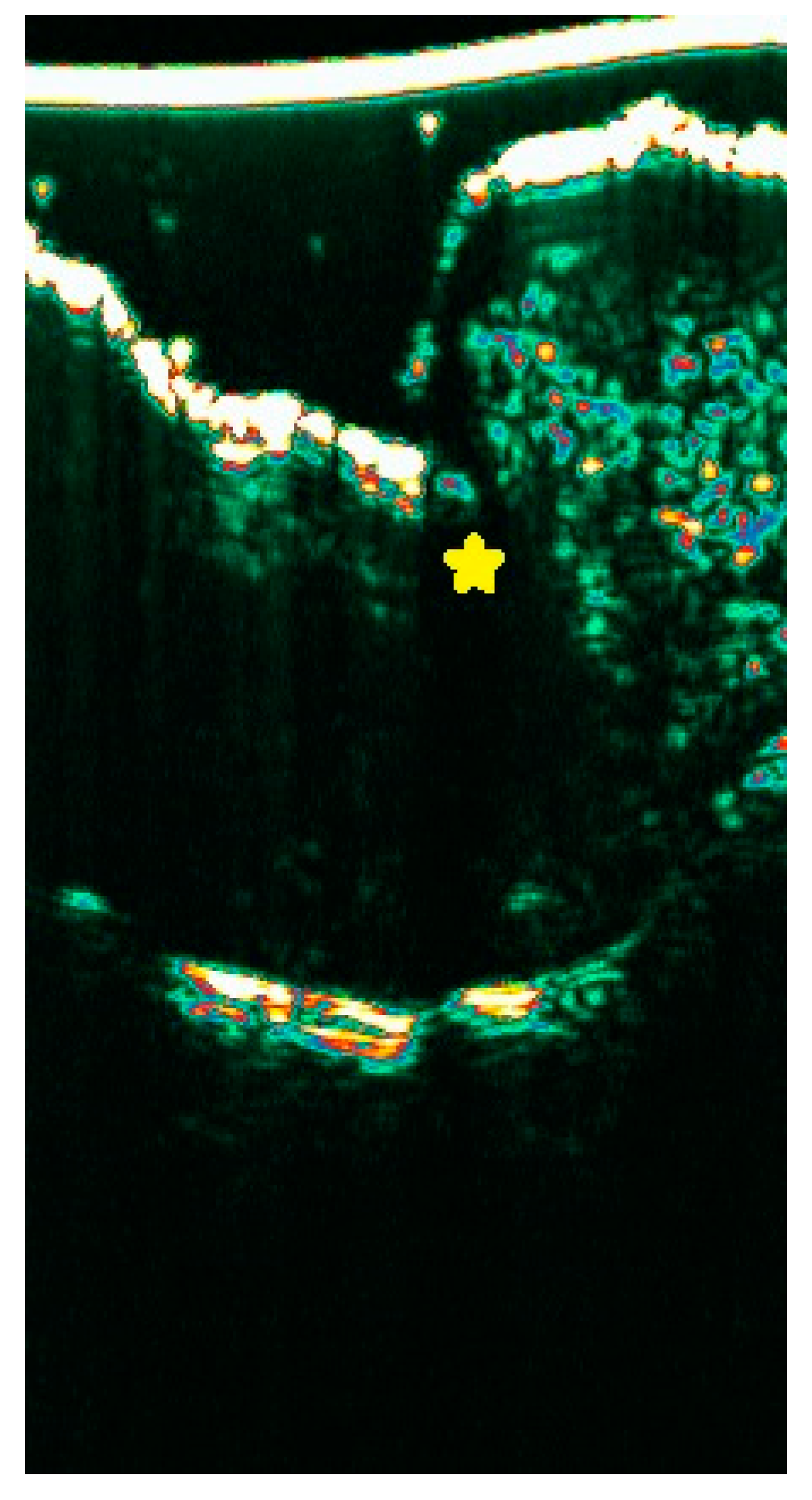 Diagnostics 15 00332 g008