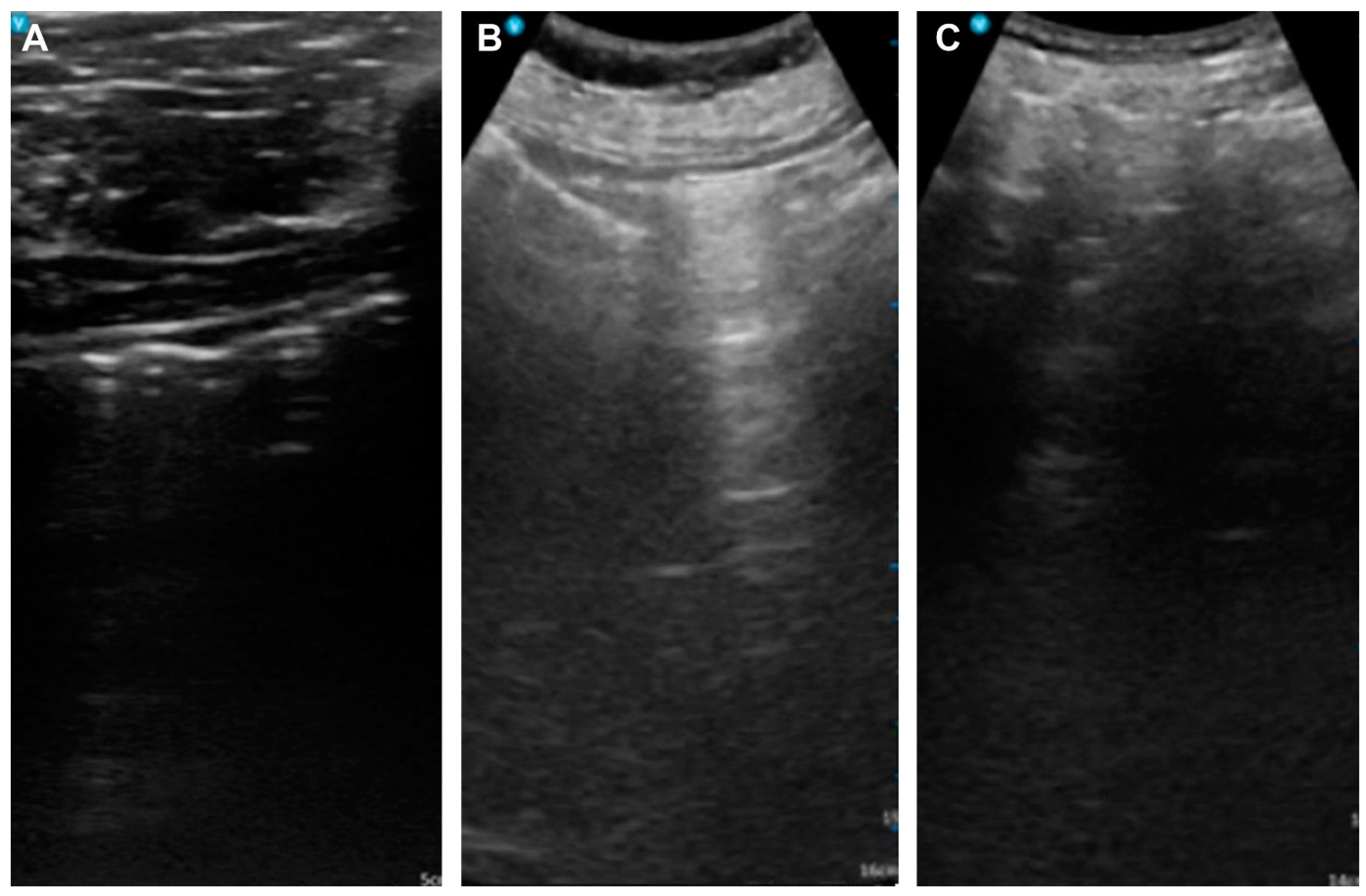 Diagnostics 15 00335 g002