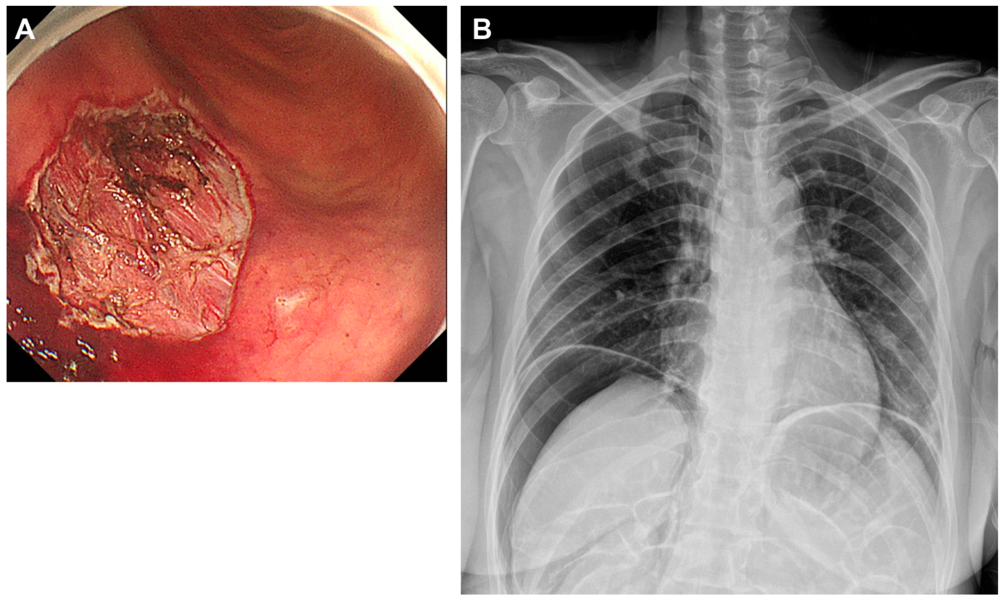 Diagnostics 15 00335 g003