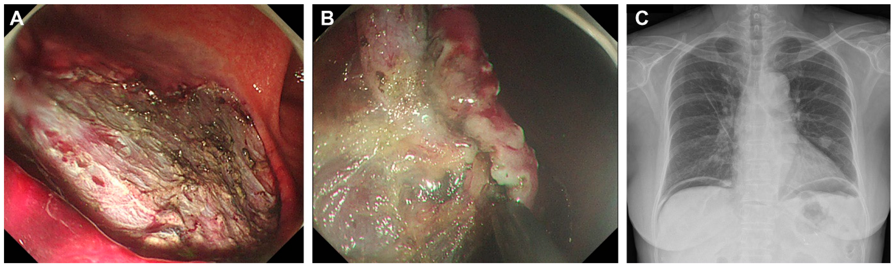 Diagnostics 15 00335 g004