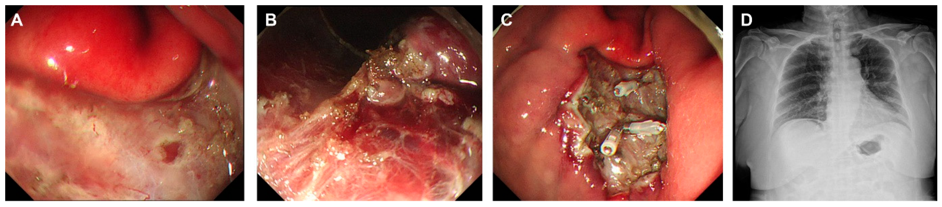 Diagnostics 15 00335 g005