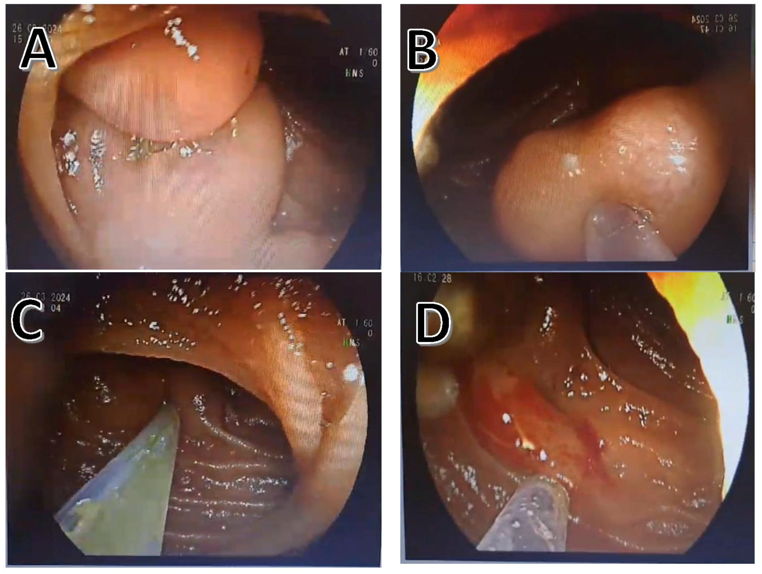 Diagnostics 15 00336 g002