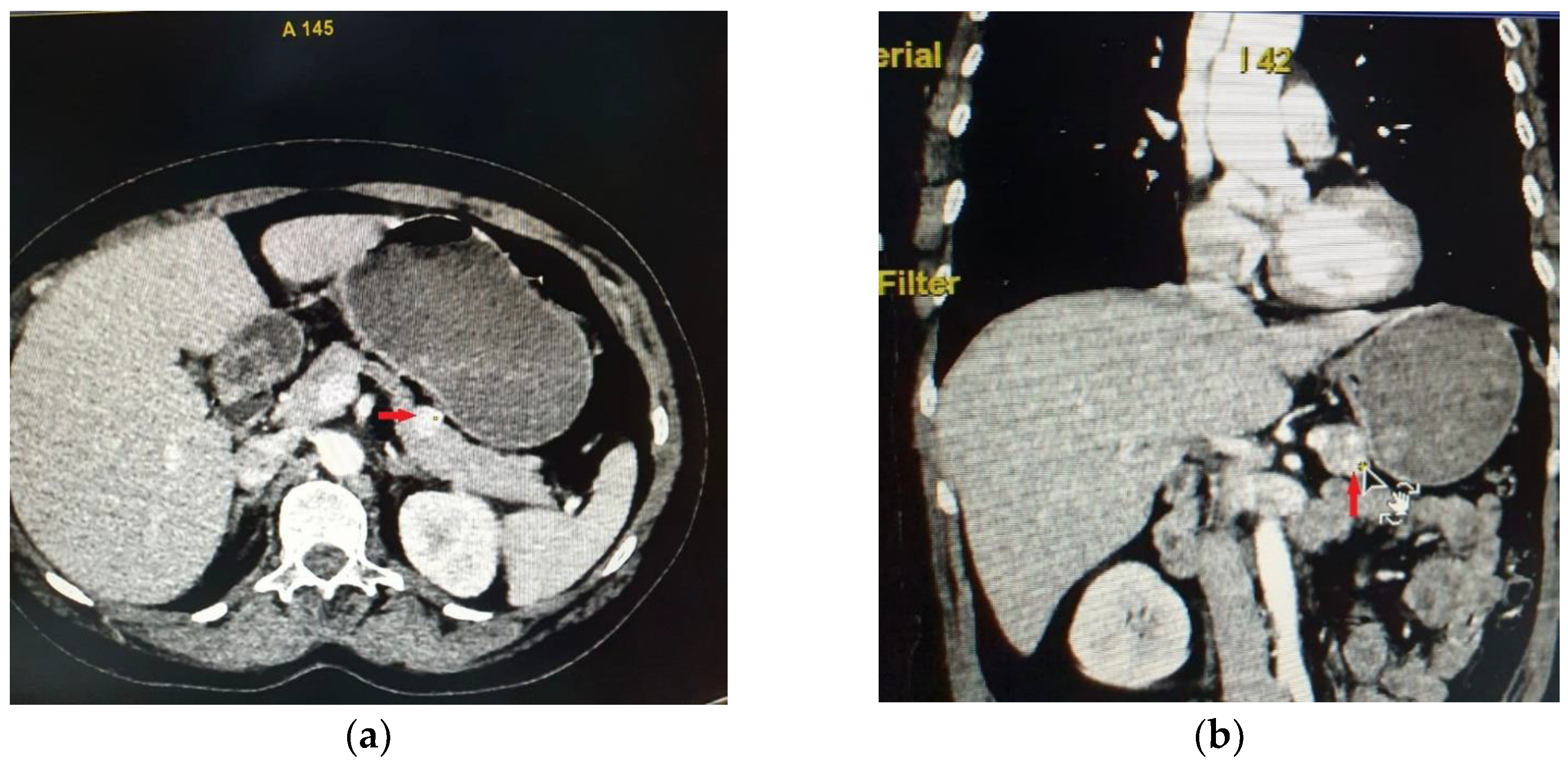 Diagnostics 15 00337 g001 Diagnostics 15 00337 g001