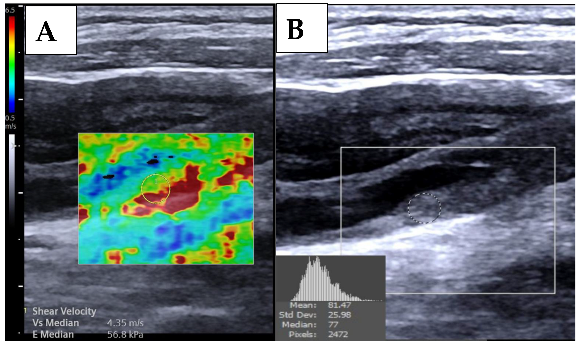 Diagnostics 15 00338 g001
