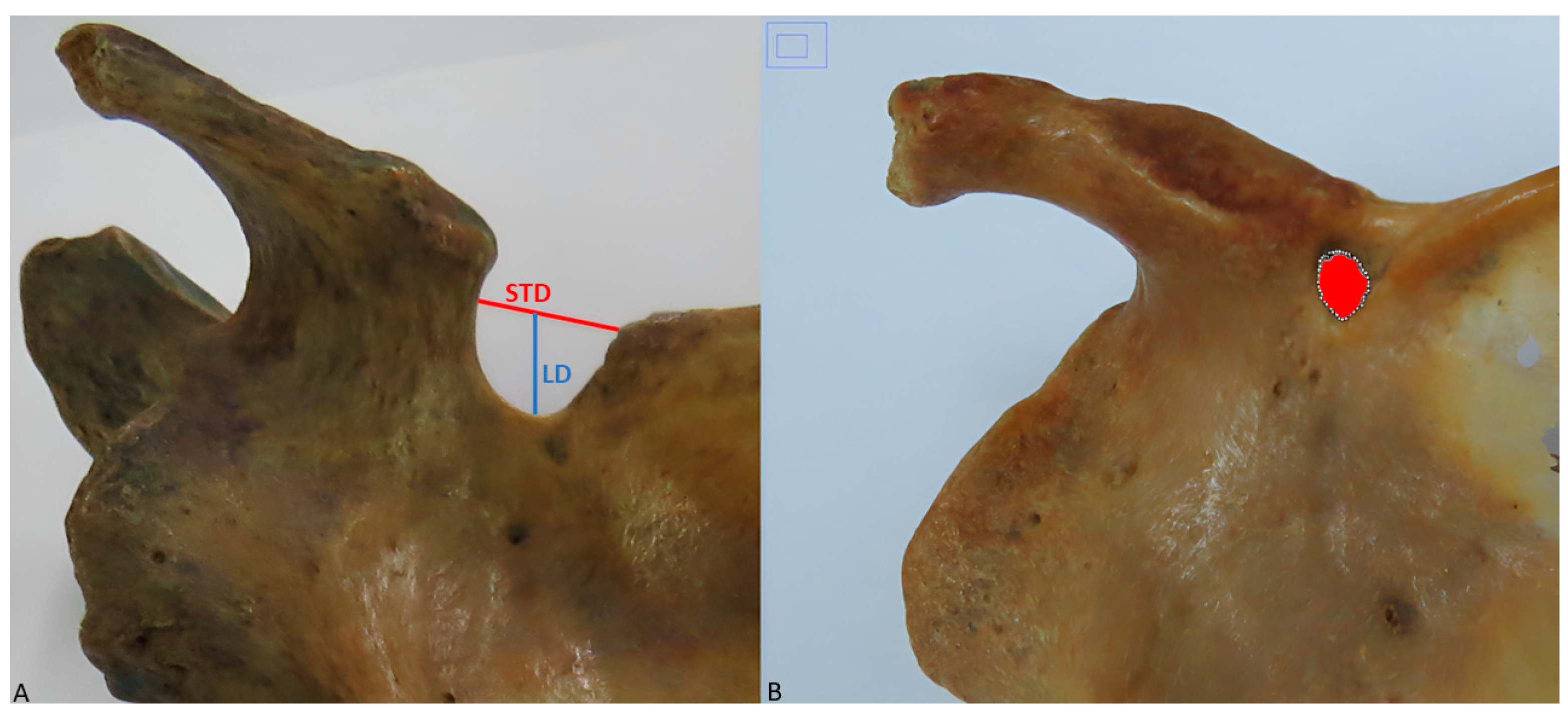 Diagnostics 15 00346 g002