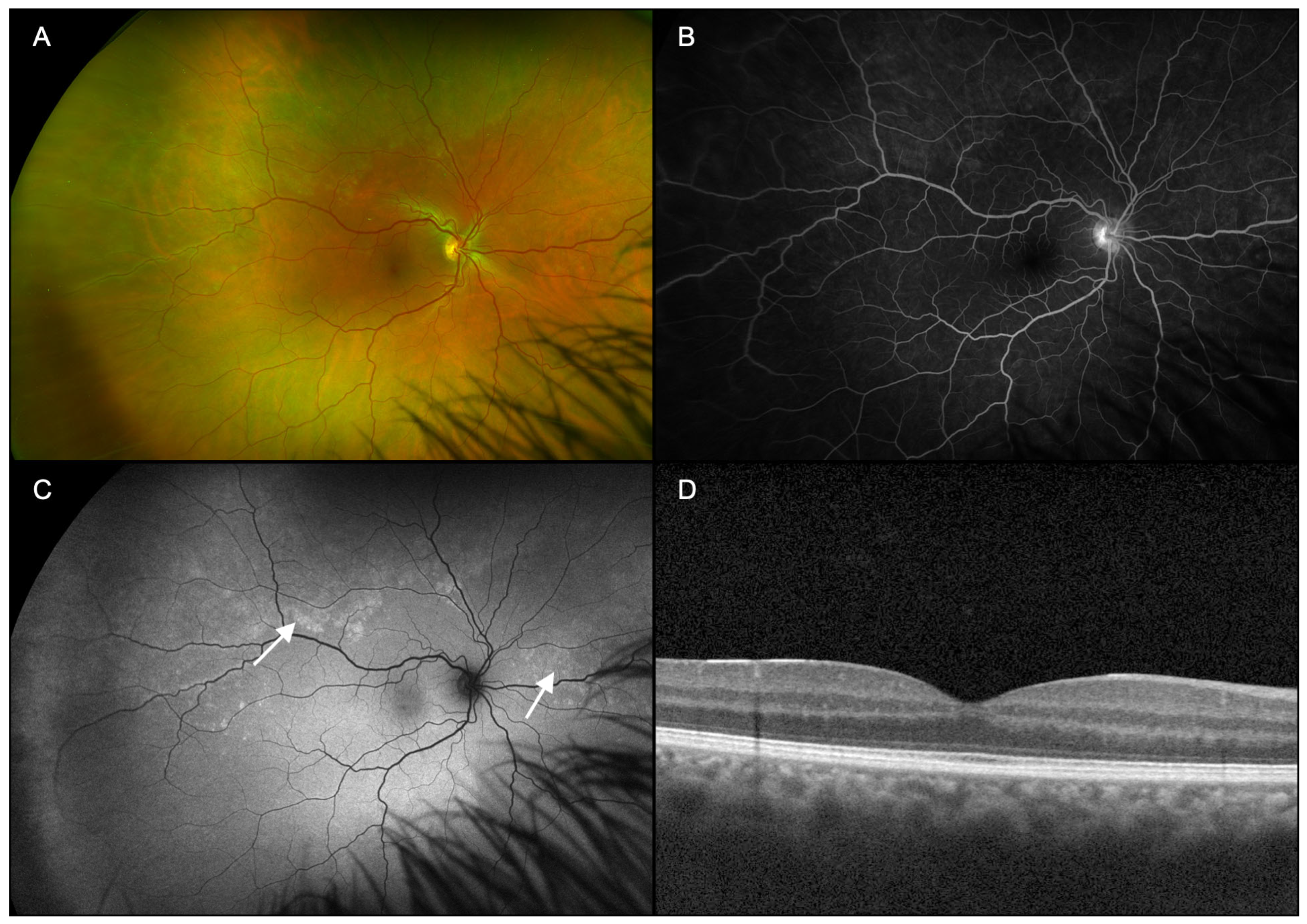 Diagnostics 15 00369 g001
