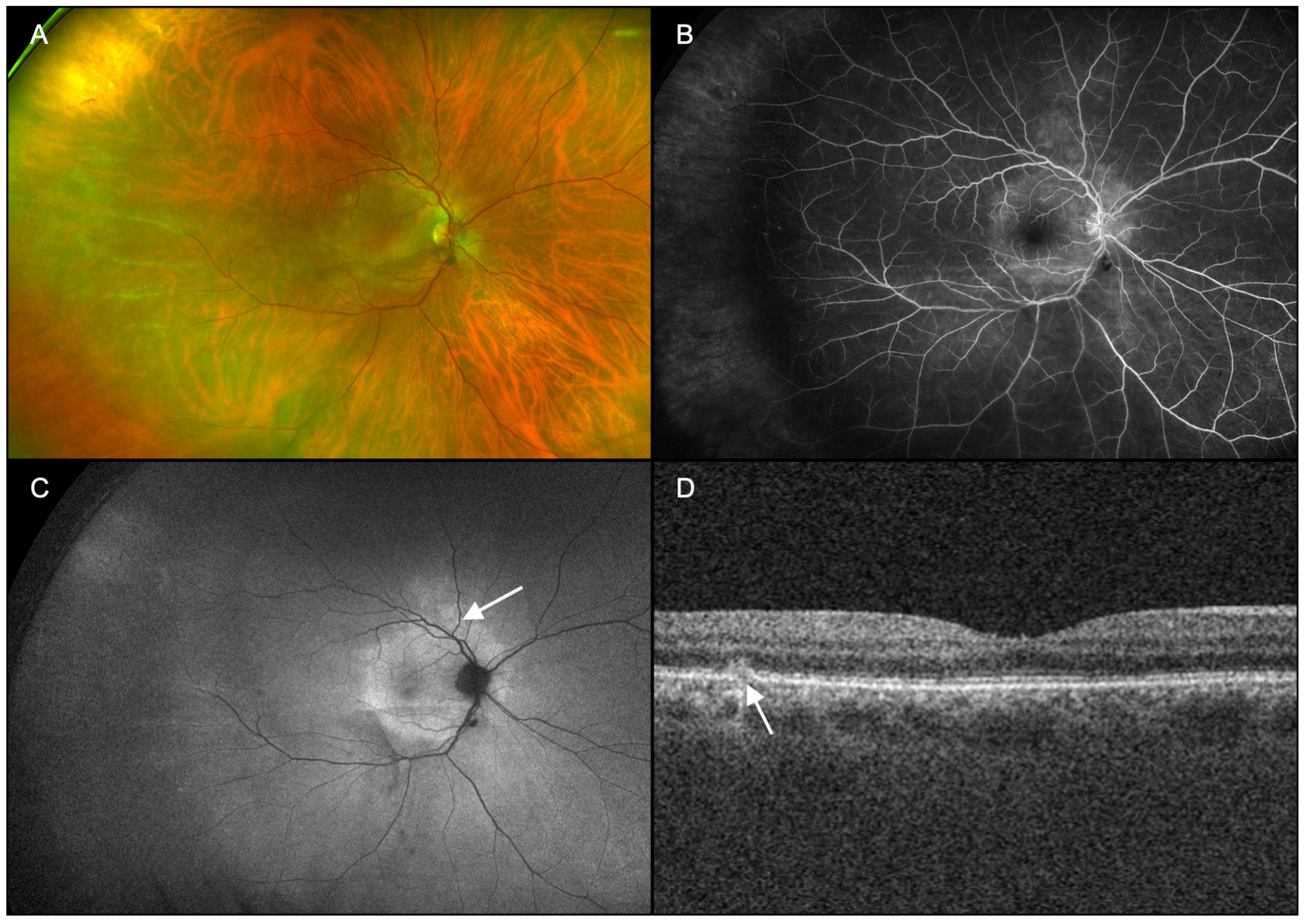 Diagnostics 15 00369 g003