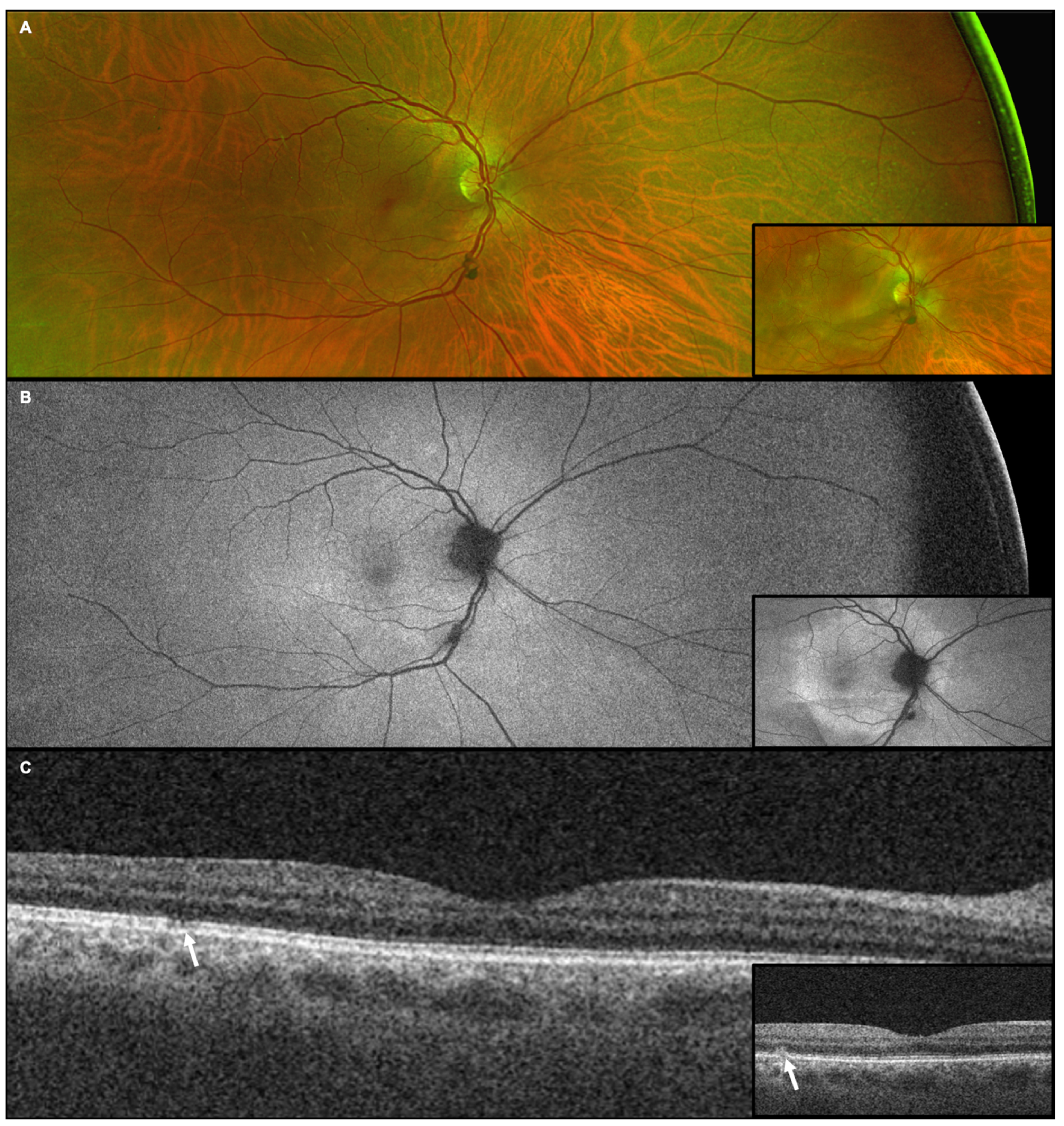 Diagnostics 15 00369 g004
