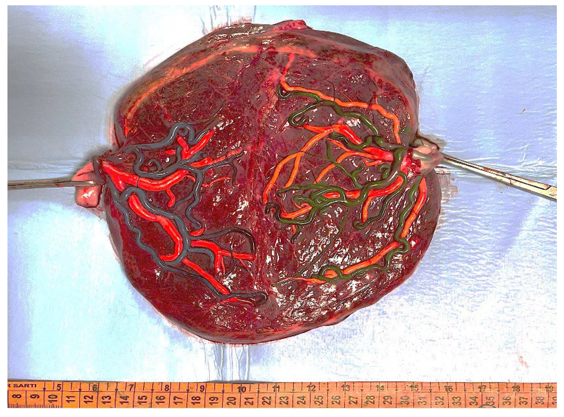 Diagnostics 15 00372 g001