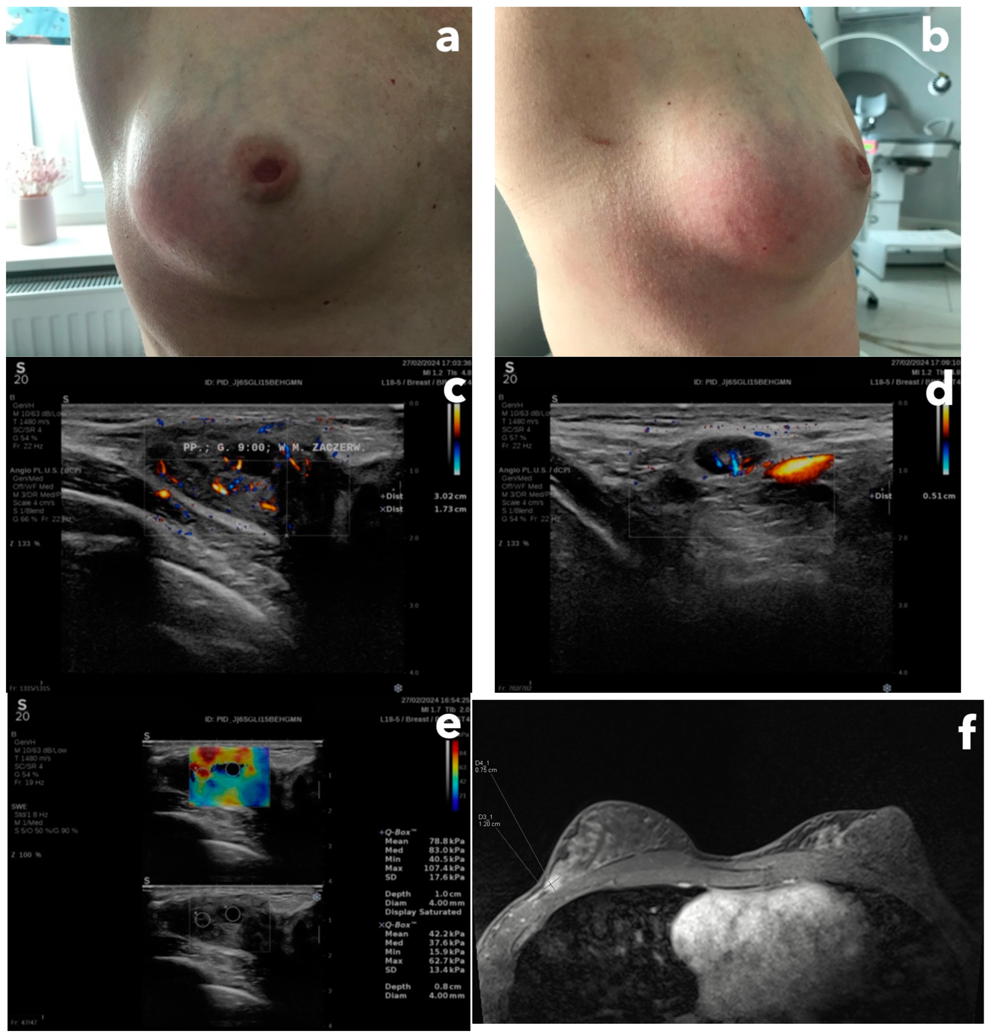 Diagnostics 15 00380 g004