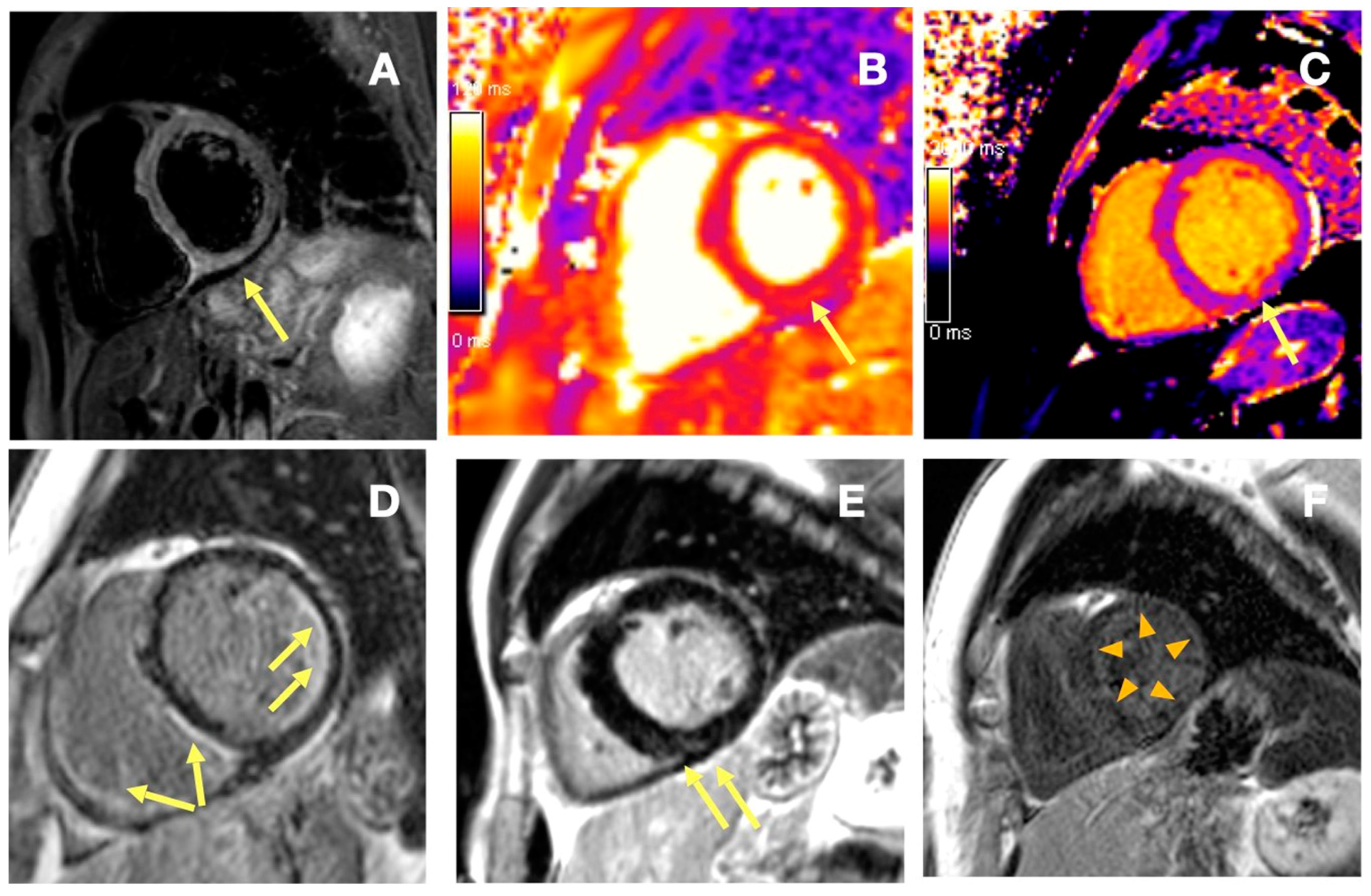 Diagnostics 15 00393 g001