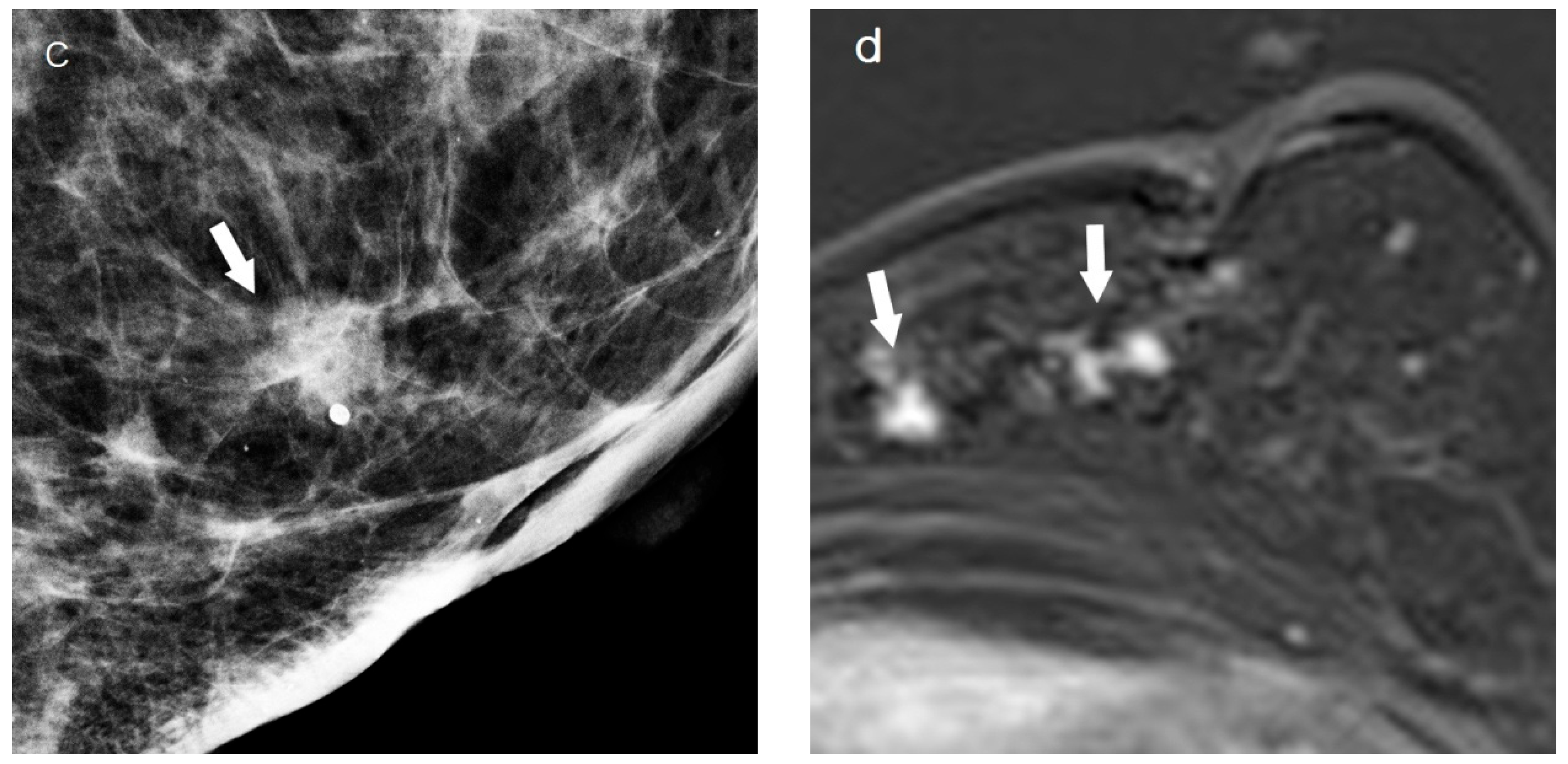 Diagnostics 15 00407 g001b