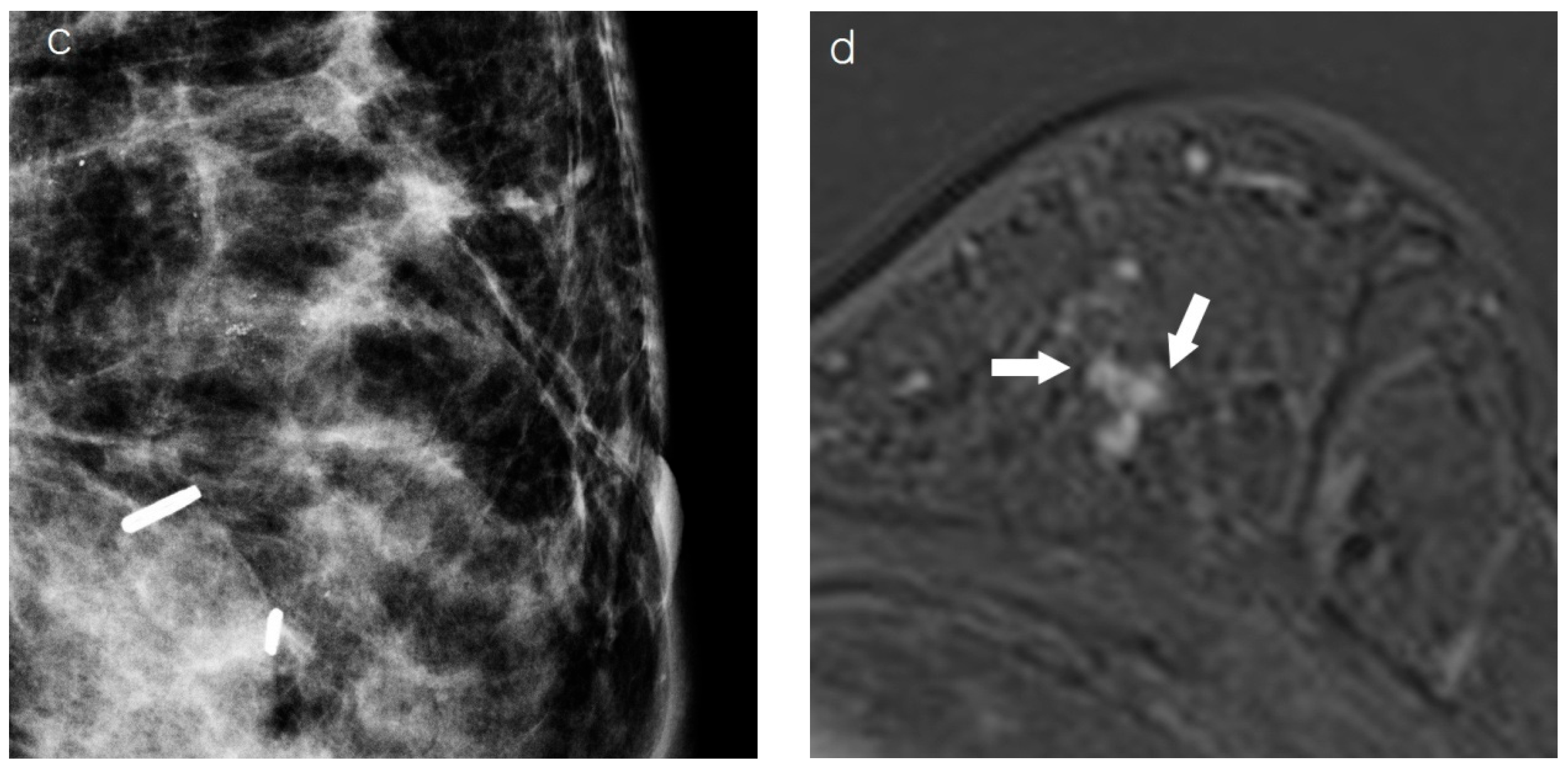 Diagnostics 15 00407 g002b
