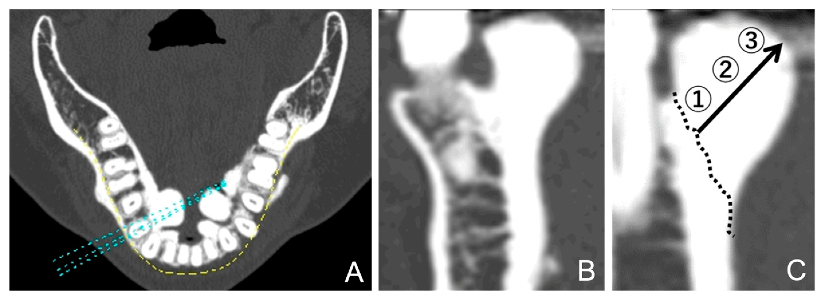 Diagnostics 15 00414 g004